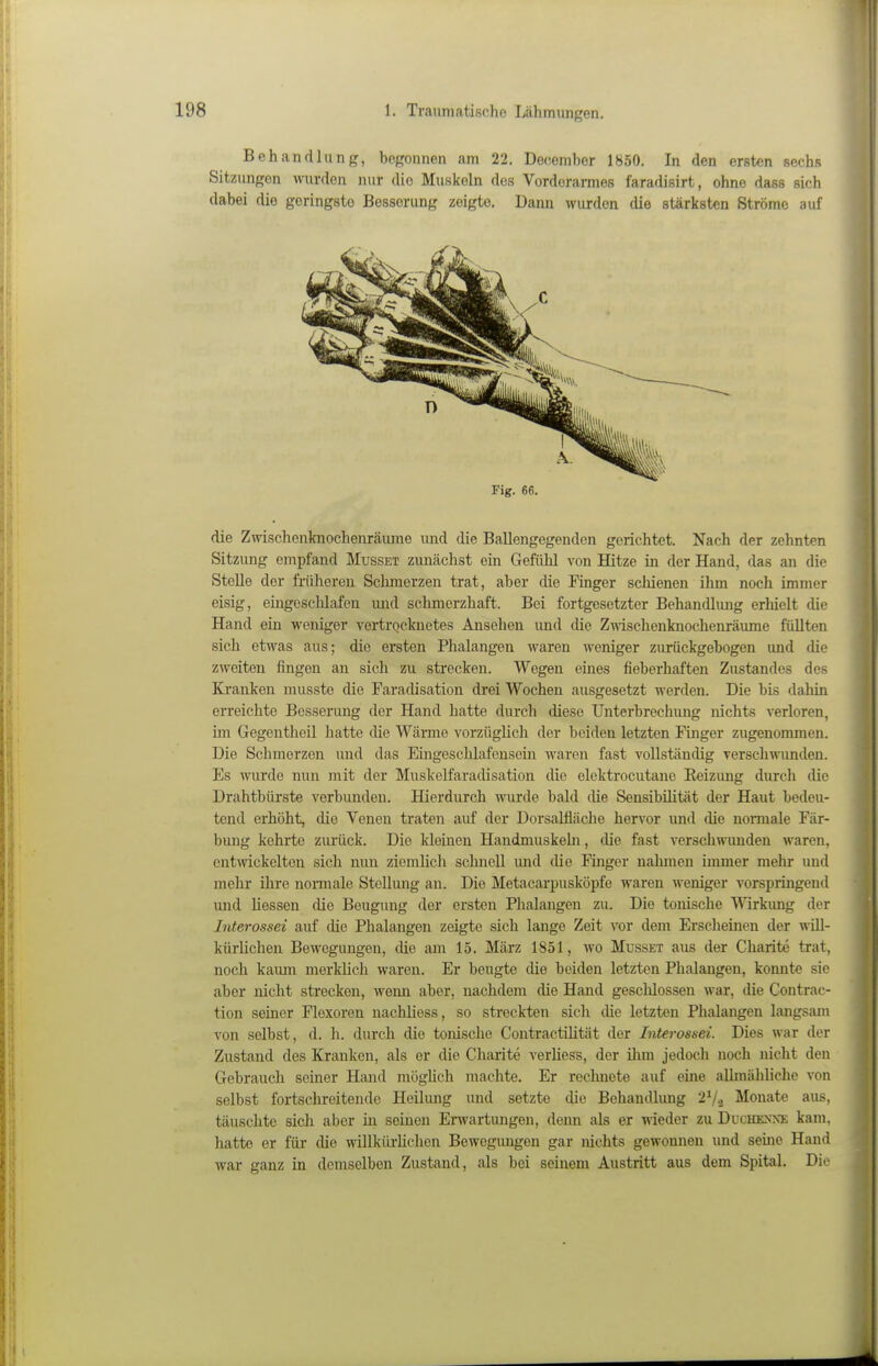 Behandlung, begonnen am 22. Deoember 1850. In den ersten sechs Sitzungen wurden nur die Muskeln des Vorderarmes faradisirt, ohne dass sich dabei die geringste Besserung zeigte. Dann wurden die stärksten Ströme auf Fig. 66. die Zwischenknochenräiinie und die Ballengegenden gerichtet. Nach der zehnten Sitzung empfand Musset zunächst ein Gefühl von Hitze in der Hand, das an die Stelle der früheren Schmerzen trat, aber die Pinger schienen ihm noch immer eisig, eingeschlafen und sclimerzhaft. Bei fortgesetzter Behandlung erliielt die Hand ein woniger vertrocknetes Ansehen und die Zmschenknochenräume füllten sich etwas aus; die ersten Phalangen waren weniger zurückgebogen und die zAveiten fingen an sich zu strecken. Wegen eines fieberhaften Zustandes des Kranken musste die Faradisation drei Wochen ausgesetzt werden. Die bis dahin erreichte Bessenmg der Hand hatte durch diese Unterbrechung nichts verloren, im Gegentheil hatte die Wärme vorzüglich der beiden letzten Finger zugenommen. Die Schmerzen und das Eingeschlafensein waren fast voUstäudig verschwunden. Es wurde nun mit der Muskelfaradisation die elektrocutane Eeizung durch die Drahtbürste verbunden. Hierdurch wurde bald die Sensibilität der Haut bedeu- tend erhöht, die Venen traten auf der Dorsalfläche hervor und die normale Fär- bung kehrte zurück. Die kleinen Handmuskebi, die fast verschwunden waren, entwickelten sich mm ziemlich sclinell und die Finger nalunen immer mehr und mehr ihre normale Stellung an. Die Metacarpusköpfc waren weniger vorspringend und Hessen die Beugmig der ersten Phalangen zu. Die tonische Wirkung der Interossei auf die Phalangen zeigte sich lange Zeit A'or dem Erscheinen der will- kürlichen Bewegungen, die am 15. März 1851, wo Musset aus der Gharite trat, noch kauni merklich waren. Er beugte die beiden letzten Phalangen, konnte sie aber nicht strecken, wemi aber, nachdem die Hand geschlossen war, die Contrac- tion seiner Plexoren nachliess, so streckten sich die letzten Phalangen langsam von selbst, d. h. durch die tonische Contractüität der Interossei. Dies war der Zustand des Kranken, als er die Gharite verliess, der ilim jedocli noch nicht den Gebrauch seiner Hand mögUch machte. Er rechnete auf eine allmähliche von selbst fortschreitende Heilung und setzte die Behandlung 2V2 Monate aus, täuschte sich aber in seinen Erwartungen, denn als er wieder zu Duohenni; kam, hatte er für die willkürlichen Bewegungen gar nichts gewonnen und seme Hand war ganz in demselben Zustand, als bei seinem Austritt aus dem Spital. Die