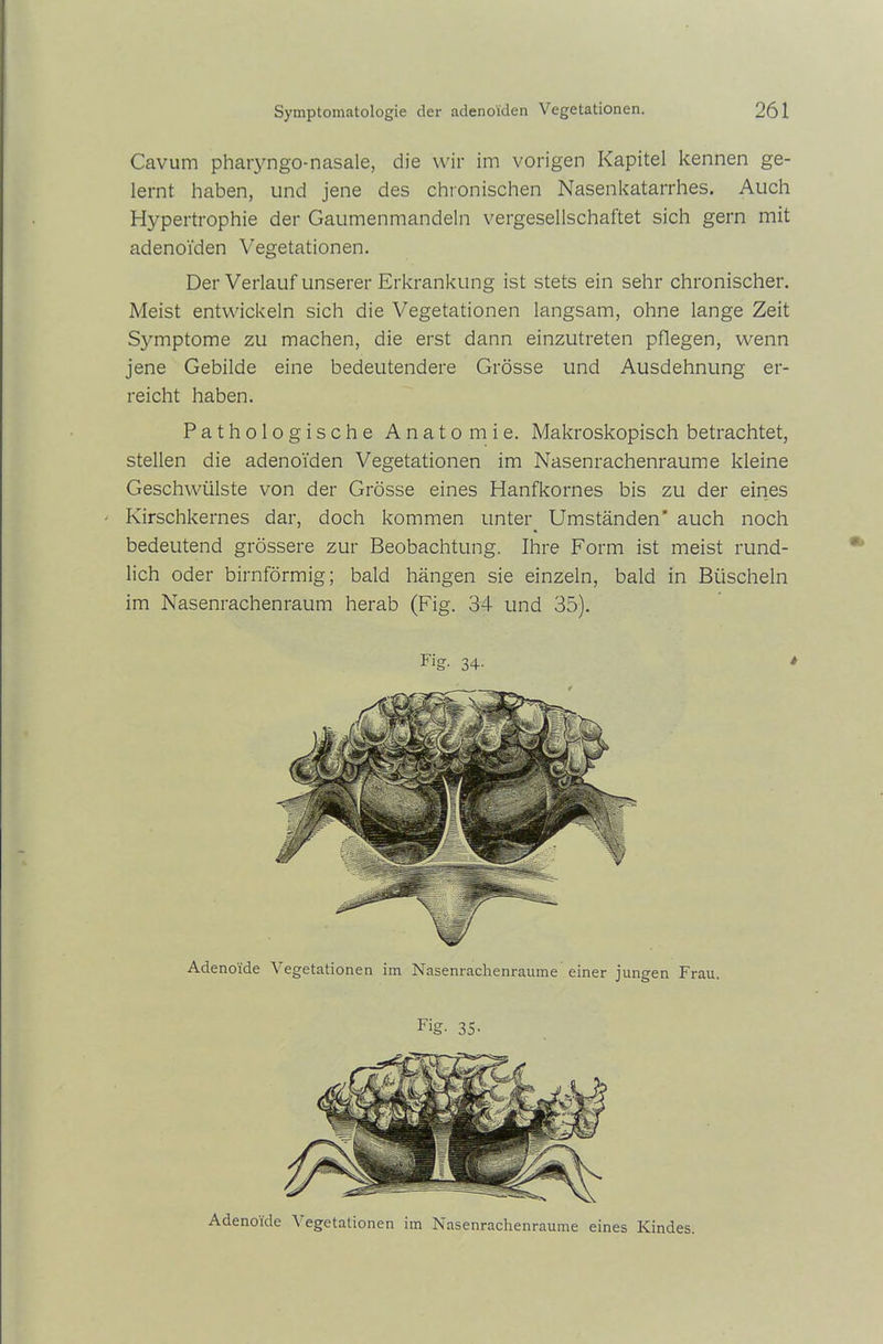 Cavum pharyngo-nasale, die wir im vorigen Kapitel kennen ge- lernt haben, und jene des chronischen Nasenkatarrhes. Auch Hypertrophie der Gaumenmandeln vergesellschaftet sich gern mit adenoiden Vegetationen. Der Verlauf unserer Erkrankung ist stets ein sehr chronischer. Meist entwickeln sich die Vegetationen langsam, ohne lange Zeit Symptome zu machen, die erst dann einzutreten pflegen, wenn jene Gebilde eine bedeutendere Grösse und Ausdehnung er- reicht haben. Pathologische Anatomie. Makroskopisch betrachtet, stellen die adenoiden Vegetationen im Nasenrachenraume kleine Geschwülste von der Grösse eines Hanfkornes bis zu der eines • Kirschkernes dar, doch kommen unter Umständen’ auch noch bedeutend grössere zur Beobachtung. Ihre Form ist meist rund- lich oder bimförmig; bald hängen sie einzeln, bald in Büscheln im Nasenrachenraum herab (Fig. 34 und 35). Fig. 34- Adenoide Vegetationen im Nasenrachenraume einer jungen Frau. Fig- 35- Adenoide Vegetationen im Nasenrachenraume eines Kindes.