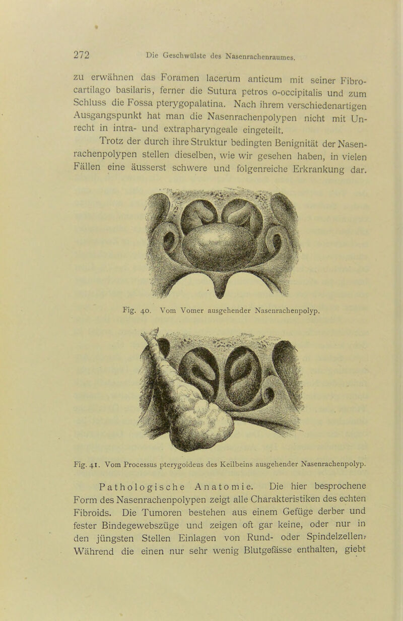 zu erwähnen das Foramen lacerum anticum mit seiner Fibro- cartilago basilaris, ferner die Sutura petros o-occipitalis und zum Schluss die Fossa pterygopalatina. Nach ihrem verschiedenartigen Ausgangspunkt hat man die Nasenrachenpolypen nicht mit Un- recht in intra- und extrapharyngeale eingeteilt. Trotz der durch ihre Struktur bedingten Benignität der Nasen- rachenpolypen stellen dieselben, wie wir gesehen haben, in vielen Fällen eine äusserst schwere und folgenreiche Erkrankung dar. Fig. 40. Vom Vomer ausgehender Nasenrachenpolyp. Fig. 41. Vom Processus pterygoideus des Keilbeins ausgehender Nasenrachenpolyp. Pathologische Anatomie. Die hier besprochene Form des Nasenrachenpolypen zeigt alle Charakteristiken des echten Fibroids. Die Tumoren bestehen aus einem Gefüge derber und fester Bindegewebszüge und zeigen oft gar keine, oder nur in den jüngsten Stellen Einlagen von Rund- oder Spindelzellen? Während die einen nur sehr wenig Blutgefässe enthalten, giebt