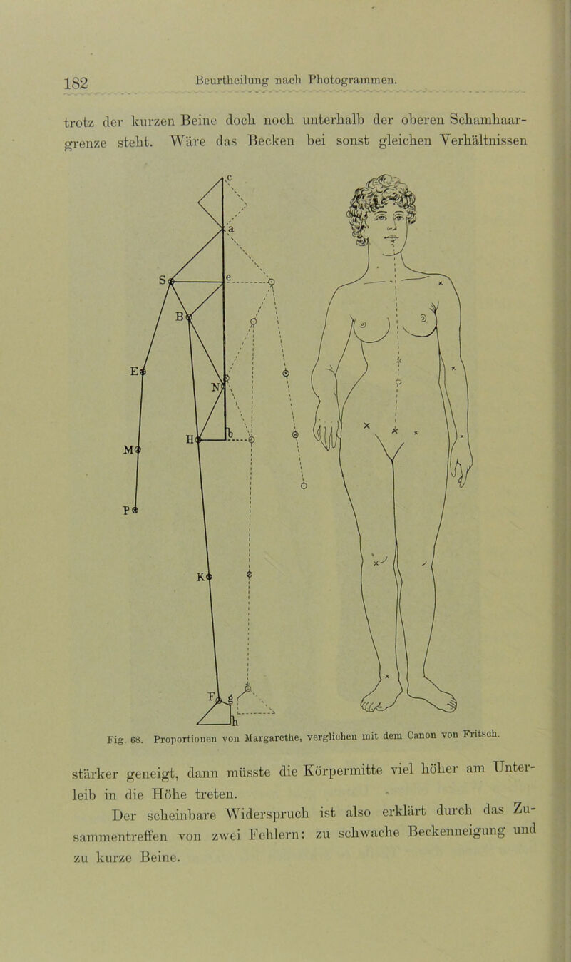 trotz der kurzen Beine dock noch nnterkalk der oberen Scbainkaar- o-renze stebt. Wäre das Becken l)ei sonst gleichen Vei'bältnissen Fig. 68. Proportionen von Margarethe, verglichen mit dem Canon von Fritsch. stärker geneigt, dann müsste die Körpermitte viel böbei am Untei leib in die Höbe treten. Der scbeinbare Widersprucb ist also erklärt diucb das Zu sammentreben von zwei Feblern: zu scbwacbe Beckenneigung und zu kurze Beine.