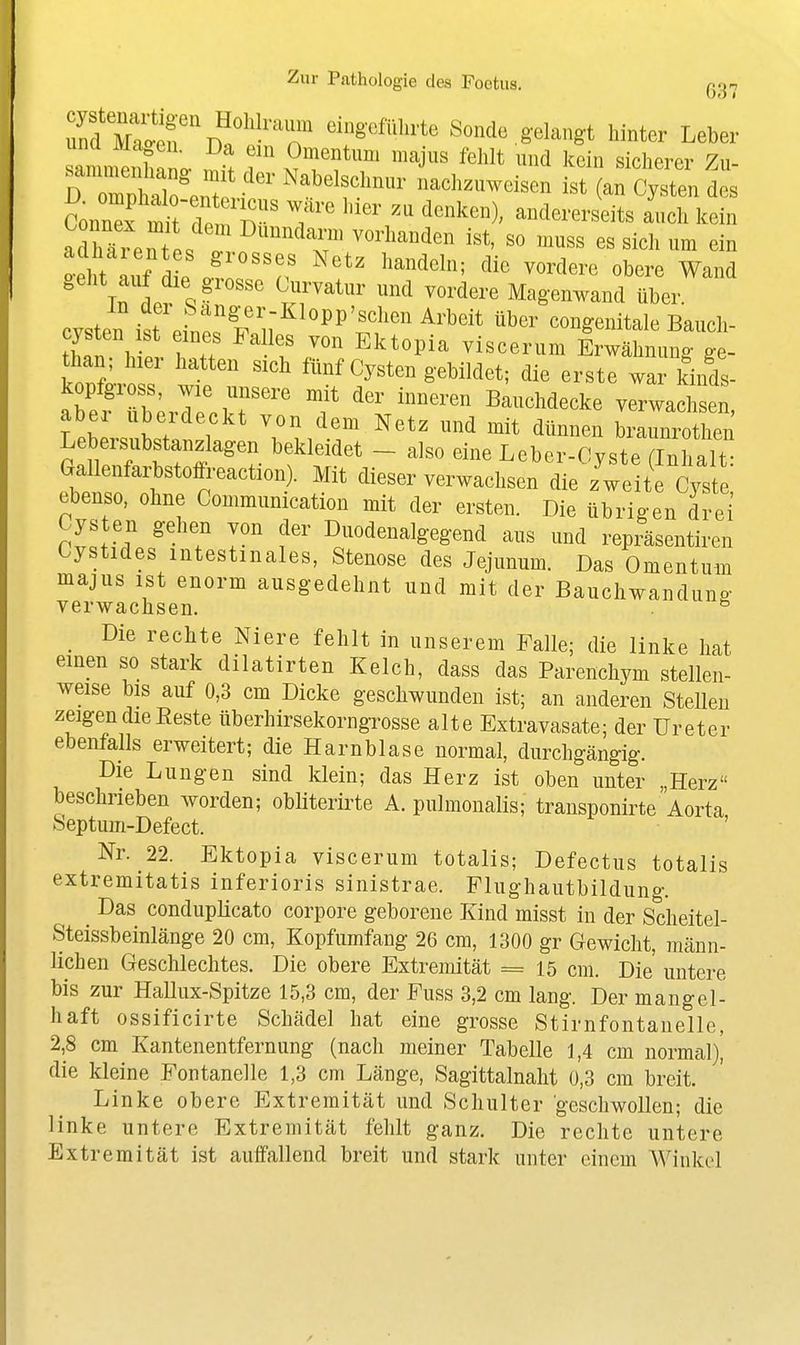 rdCcf\?'^T ^■'^■^■^^'^ Sonde,gelangt hinter Leber und Magen. Da ein Omentum majus fehlt und kein sicherer Zu- änn^f ^tllerrr' ''''' andererseits auch kein adhTre^ T ^''''''^T ''''^'^''^'^ i«*' «o muss es sich um ein o'eht auf d P /. '''n ^«^^^^^^^ «^ere Wand Tn Iv 4 ^.T'' ^^^ ^^^•'^^^•^ Magenwand über. cvsten ist eint f'i; ^^^'^'^^' ^'^'^ congenitale Baucli- cysten ist eines Salles von Ektopia viscerum Erwähnuno- ^e- than; h,er hatten sich fünf Cysten gebildet; die erste wa kinds- kopfgross, wie unsere mit der inneren Bauchdecke verwachsen aber uberdeckt von dem Netz und mit dünnen braunrothen Lebersubstanzlagen bekleidet - also eine Leber-Cyste (Inhalt: Gallenfarbstoffreaction). Mit dieser verwachsen die z weite Cyste ebenso, ohne Commumcation mit der ersten. Die übrigen drei Cysten gehen von der Duodenalgegend aus nnd repräsentiren Cystides intestinales, Stenose des Jejunum. Das Omentum majus ist enorm ausgedehnt und mit der Bauchwandung verwachsen. . ^ _ Die rechte Niere fehlt in unserem Falle; die linke hat einen so stark dilatirten Kelch, dass das Parenchym stellen- weise bis auf 0,3 cm Dicke geschwunden ist; an anderen Stellen zeigen die Beste überhirsekorngrosse alte Extravasate; der Ureter ebenfalls erweitert; die Harnblase normal, durchgängig. Die Lungen sind klein; das Herz ist oben unter „Herz beschrieben worden; obliterirte A. pulmonalis; transponirte Aorta Septum-Defect. Nr. 22. Ektopia viscerum totalis; Defectus totalis extremitatis inferioris sinistrae. Flughautbildung. Das conduplicato corpore geborene Kind misst in der Scheitel- Steissbeinlänge 20 cm, Kopfumfang 26 cm, 1300 gr Gewicht, männ- lichen Geschlechtes. Die obere Extremität = 15 cm. Die untere bis zur Halliix-Spitze 15,3 cm, der Fuss 3,2 cm lang. Der mangel- haft ossificirte Schädel hat eine grosse Stirnfontanelle, 2,8 cm Kantenentfernung (nach meiner Tabelle 1,4 cm normal)' die kleine Fontanelle 1,3 cm Länge, Sagittalnalit 0,3 cm breit. Linke obere Extremität und Schulter geschwollen; die linke untere Extremität fehlt ganz. Die rechte untere Extremität ist aulfallend breit und stark unter einem Winkel
