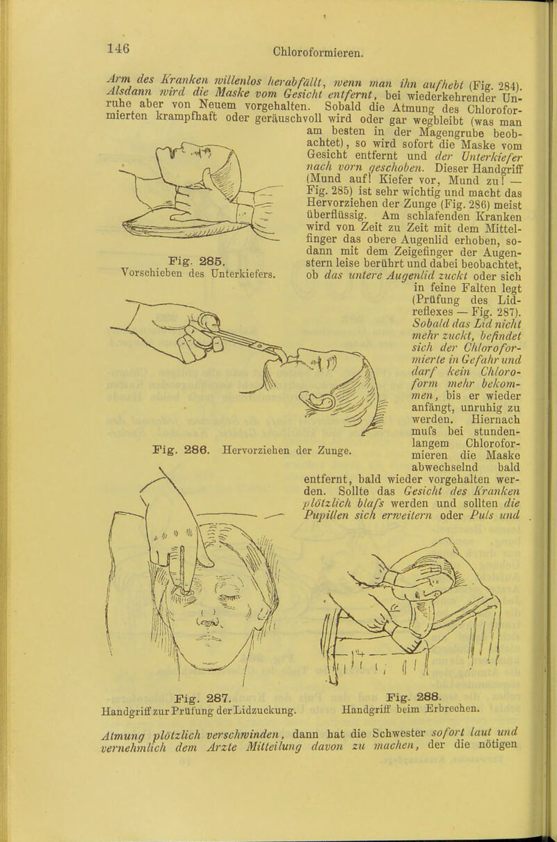 146 Chloroformieren. Fig. 285. Vorschieben des Unterkiefers. ^7-»» des Kranken willenlos herabfällt, ivenn man ihn aufhebt (Fie 284) Alsdann ?vtrd die Maske vom Gesicht entfernt, bei wiederkehrender Un- ruhe aber von Neuem vorgehalten. Sobald die Atmung des Chlorofor- mierten krampfhaft oder geräuschvoll wird oder gar wegbleibt (was man am besten in der Magengrube beob- achtet), so wird sofort die Maske vom Gesicht entfernt und der Unterkiefer nach vorn geschoben. Dieser Plandgriff (Mund auf! Kiefer vor, Mund zu! — Fig. 285) ist sehr wichtig und macht das Hervorziehen der Zunge (Fig. 286) meist überflüssig. Am schlafenden Kranken wird von Zeit zu Zeit mit dem Mittel- finger das obere Augenlid erhoben, so- dann mit dem Zeigefinger der Augen- stern leise berührt und dabei beobachtet, ob das untere Augenlid zuckt oder sich in feine Falten legt (Prüfung des Lid- reflexes — Fig. 287). Sobald das Lid nicht mehr zuckt, befindet sich der Chlorofor- mierte in Gefahr und darf kein Chloro- form mehr bekom- men, bis er wieder anfängt, unruhig zu werden. Hiernach mufs bei stunden- langem Chlorofor- mieren die Maske abwechselnd bald entfernt, bald wieder vorgehalten wer- den. Sollte das Gesicht des Kranken plötzlich blafs werden und sollten die Pujnllen sich ermeilern oder Puls und Fig. 286. Hervorziehen der Zunge. Fig. 287. Fig. 288. Handgriff zur Prüfung der Lidzuckung. Handgriff beim Erbrechen. Atmung plötzlich verschwinden, dann hat die Schwester sofort laut und vernehmlich dem Arzte Mitteilung davon zu machen, der die nötigen