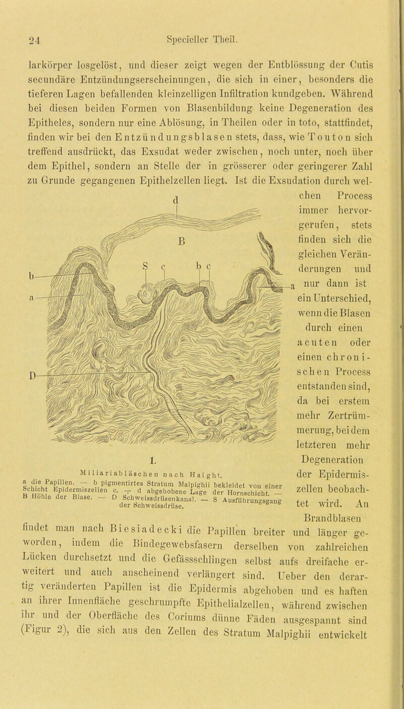 larkörper losgelöst, und dieser zeigt wegen der Entblössung der Cutis secundärc Entzündungserscheinungen, die sich in einer, besonders die tieferen Lagen befallenden kleinzelligen Infiltration kundgeben. Während bei diesen beiden Formen von Blasenbildung keine Degeneration des Epitheles, sondern nur eine Ablösung, in Theilen oder in toto, stattfindet, finden wir bei den Entzündungsblasen stets, dass, wie Touton sich treffend ausdrückt, das Exsudat weder zwischen, noch unter, noch über dem Epithel, sondern an Stelle der in grösserer oder geringerer Zahl zu Grunde gegangenen Epithelzellen liegt. Ist die Exsudation durch wel- chen Process immer hervor- gerufen , stets finden sich die gleichen Verän- derungen und ( nur dann ist ein Unterschied, wenn die Blasen durch einen acuten oder einen chroni- schen Process entstanden sind, da bei erstem mehr Zertrüm- merung, bei dem letzteren mehr Degeneration der Epidermis- zellen beobach- tet wird. An Brandblasen findet man nach B ie siad e cki die Papillen breiter und länger ge- worden, indem die Bindegewebsfasern derselben von zahlreichen Lücken durchsetzt und die Gefässschlingen selbst aufs dreifache er- weitert und auch anscheinend verlängert sind. Heber den derar- tig veränderten Papillen ist die Epidermis abgehoben und es haften an ihrer Innenfläche geschrumpfte Epithelialzellen, während /.wischen ihr und der Oberfläche des Coriums dünne Fäden ausgespannt sind (Figur 2), die sich aus den Zellen des Stratum Malpighii entwickelt Miliariabläschen nach Haight. we>,ra£il^n- 7 I?Pißmemi't« Stratum Malpighii bekleidet von einer B HöhL Ä« n r, d .abSehobene Lage der Hornschicht. - Hohle der Blase- - D ScbweissdrUsenkaual. - S Ausfiihrun»seauc der Schweissdrüse. °