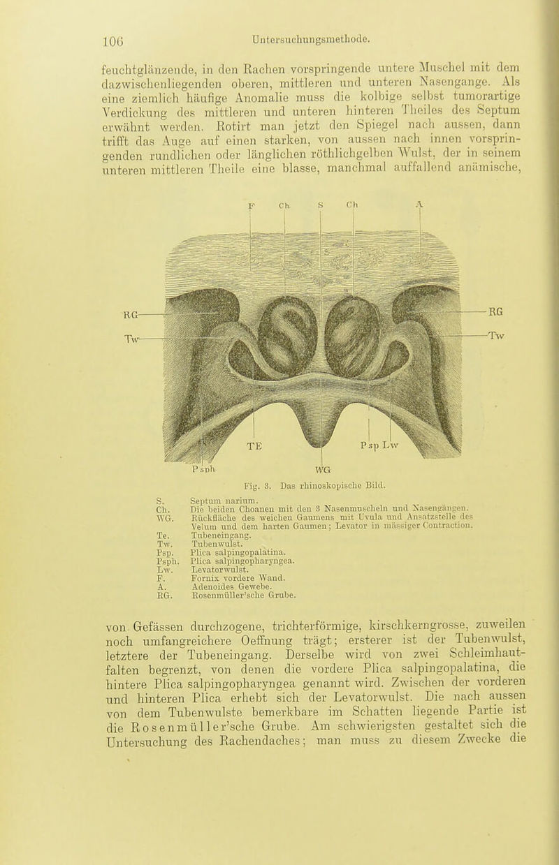 feuchtglilnzende, in den Radien vorspringende untere Muschel mit dem dazwischenliegenden oberen, mittleren und unteren Nasengange. Als eine ziemlich häufige Anomalie muss die kolbige selbst tumorartige Verdickung des mittleren und unteren hinteren Tlieiles des Septum erwähnt werden, ßotirt man jetzt den Spiegel nach aussen, dann trifft das Auge auf einen starken, von aussen nach innen vorsprin- genden rundlichen oder länglichen röthlichgelben Wulst, der in seinem unteren mittleren Theile eine blasse, manchmal auffallend anämische, Fij^. 3. Das rhinoskojjisclie Bild. S. Septum narium. Ch. Die beiden Choanen mit den 3 Nasenmnscheln und Xasengäiipen. WG. Rückfläclie des weichen Ganmens mit Uvula und Ansatzstelle des Velnin und dem harten Gaumen; Levator in massiger Contractiou. Te. Tnbeneingang. Tw. Tubenwulst. Psp. Plica salpingopalatina. Psph. Plica salpingopliaryngea. Lw. Levatorwulst. F. Fornix vordere Wand. A. Adenoides Gewebe. EG. Kosenmüller'sche Grube. von Gefässen durchzogene, trichterförmige, kirschkerngrosse, zuweilen noch umfangreichere Oeffnung trägt; ersterer ist der Tuben\vulst, letztere der Tubeneingang. Derselbe wird von zwei Schleimhaut- falten begrenzt, von denen die vordere Plica salpingopalatina, die hintere Plica salpingopharyngea genannt wird. Zwischen der vorderen und hinteren Plica erhebt sich der Levatorwulst. Die nach aussen von dem Tubenwulste bemerkbare im Schatten liegende Partie ist die Rosenmül ler'sche Grube. Am schwierigsten gestaltet sich die Untersuchung des Rachendaches; man muss zu diesem Zwecke die