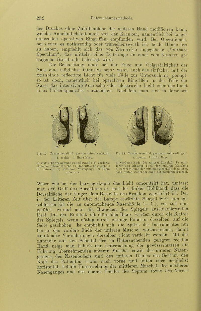 des Druckes ohne Zuhilfenahme der anderen Hand modificiren kann, welche Annehmlichkeit auch von den Kranken, namentlich bei länger dauernden operativen Eingriffen, empfunden wird. Bei Operationen, bei denen es nothwendig oder wünschenswerth i.st, beide Hände frei zu haben, empfiehlt sich das von Zarniko angegebene „fixirbare Speculum, das mittelst einer Leitstange an einer vom Kranken ge- tragenen Stirnbinde befestigt wird. Die Beleuchtung muss bei der Enge und Vielgcstaltigkeit der Nase eine möglichst intensive sein; wenn auch das einfache, mit der Stirnbinde reflectirte Licht für viele Fälle zur Untersuchung genügt, so ist doch, namentlich bei operativen Eingriffen in der Tiefe der Nase, das intensivere Auer'sche oder elektrische Licht oder das Licht eines Linsenapparates vorzuziehen. Nachdem man sich in derselben Fig. 17. NasonspiegolbiUl, perspectiviacli verkiuzt. r. rechto, 1. Huko Niise. a) seiiki'ooht vorlaufende Scheidewiiud; b) vorderes Ende der unteren Qluscliel; c) der mittleren Muschel; d) unterer; e) mittlerer Nusengang; fj Bima olt'ivctoria. Fig. 18. Nasenspi^gelbild, perspectirischverlängert, r. rechte. 1. liuko Nase. a) vorderes Eude der unteren Muschel; b) mitt- lerer und hinterer Theil der unteren Muschel: c) vorderes Eude der mittlereu Muschel; d) unterer, nach hinten ziehender Hand der mittleren Muschel. Weise wie bei der Laryngoskopie das Licht concentrirt hat, umfasst man den Griff des Speculums so mit der linken Hohlhand, dass die Dorsalfläche der Finger dem Gesichte des Kranken zugekehrt ist. Der in der kälteren Zeit über der Lampe erwärmte Spiegel wird nun ge- schlossen in die zu untersuchende Nasenhöhle 1—l'/j cm tief ein- geführt, worauf man die Branchen des Spiegels auseinandertreten lässt Die den Einblick oft störenden Haare werden durch die Blätter des Spiegels, wenn nöthig durch geringe Eotation desselben, auf die Seite geschoben. Es empfiehlt sich, die Spitze des Instrumentes nur bis an das vordere Ende der unteren Muschel vorzuschieben, damit krankhafte Veränderungen derselben nicht verdeckt werden. Mit der nunmehr auf den Scheitel des zu Untersuchenden gelegten rechten Hand neige man behufs der Untersuchung der gewissermassen die Führung übernehmenden unteren Muschel sowie des unteren Nasen- ganges, des Nasenbodens und des unteren Theiles des Septum den Kopf des Patienten etwas nach vorne und unten oder möglichst horizontal, behufs Untersuchung der mittleren Muschel, des mittleren Nasenganges und des oberen Theiles des Septum sowie des Nasen-