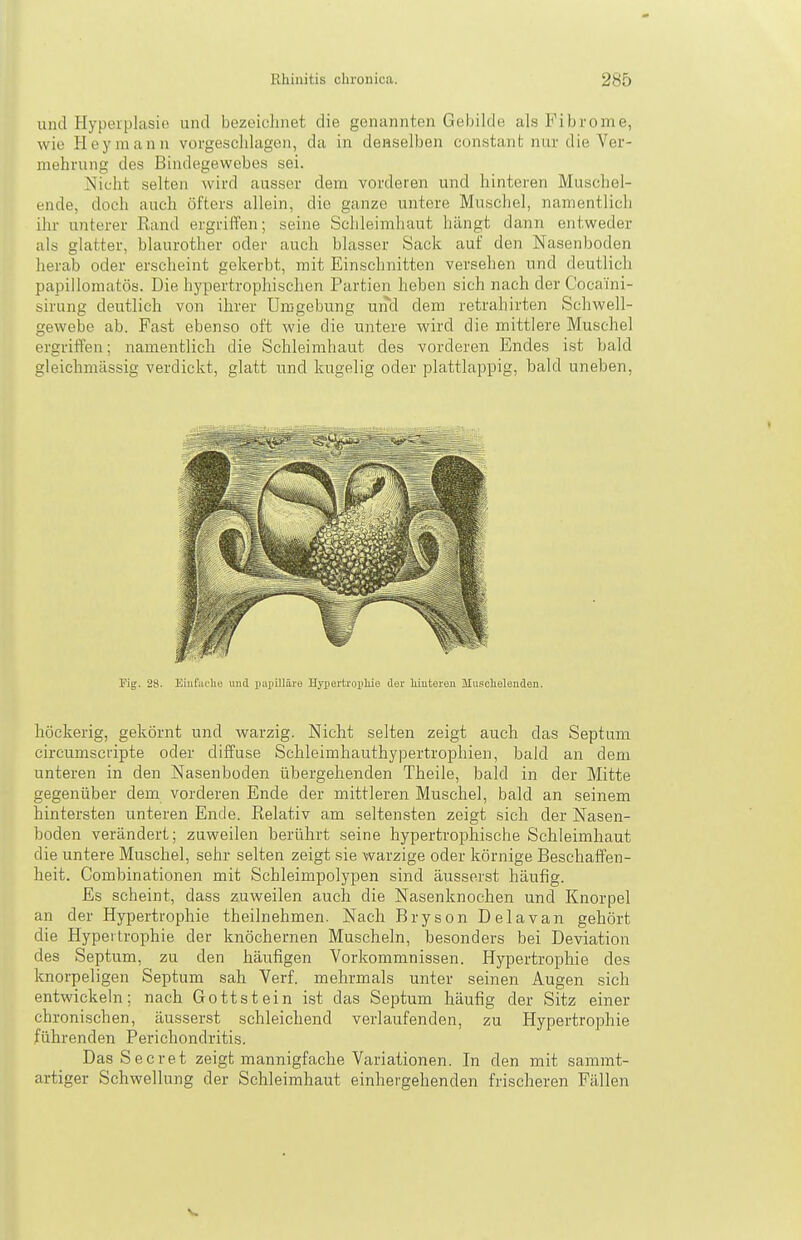 und Hyperplasie und bezeiulmet die genannten Gebilde als Fibrome, wie Hey mann vorgeschlagen, da in denselben constant nur die Ver- mehrung des Bindegewebes sei. jSIicht selten wird ausser dem vorderen und hinteren Muschel- ende, doch auch öfters allein, die ganze untere Muschel, namentlich ihr unterer Rand ergriffen; seine Schleimhaut hängt dann entweder als glatter, blaurother oder auch blasser Sack auf den Nasenboden herab oder erscheint gekerbt, mit Einschnitten versehen und deutlich papillomatös. Die hypertrophischen Partien heben sich nach der Coca'ini- sirung deutlich von ihrer Umgebung und dem retrahirten Schwell- gewebe ab. Fast ebenso oft wie die untere wird die mittlere Muschel ergriffen; namentlich die Schleimhaut des vorderen Endes ist bald gleichmässig verdickt, glatt und kugelig oder plattlappig, bald uneben, Fig. 28. Eiiif;ii'lic und papilläre Hypertropliie der hiuteren Musclielenden. höckerig, gekörnt und warzig. Nicht selten zeigt auch das Septum circumscripte oder diffuse Schleimhauthypertrophien, bald an dem unteren in den Nasenboden übergehenden Theile, bald in der Mitte gegenüber dem vorderen Ende der mittleren Muschel, bald an seinem hintersten unteren Ende. Relativ am seltensten zeigt sich der Nasen- boden verändert; zuweilen berührt seine hypertrophische Schleimhaut die untere Muschel, sehr selten zeigt sie warzige oder körnige Beschaffen- heit. Combinationen mit Schleimpolypen sind äusserst häufig. Es scheint, dass zuweilen auch die Nasenknochen und Knorpel an der Hypertrophie theilnehmen. Nach Bryson Delavan gehört die Hypertrophie der knöchernen Muscheln, besonders bei Deviation des Septum, zu den häufigen Vorkommnissen. Hypertrophie des knorpeligen Septum sah Verf. mehrmals unter seinen Augen sich entwickein; nach Gottstein ist das Septum häufig der Sitz einer ch ronischen, äusserst schleichend verlaufenden, zu Hypertrophie führenden Perichondritis. Das Secret zeigt mannigfache Variationen. In den mit sammt- artiger Schwellung der Schleimhaut einhergehenden frischeren Fällen