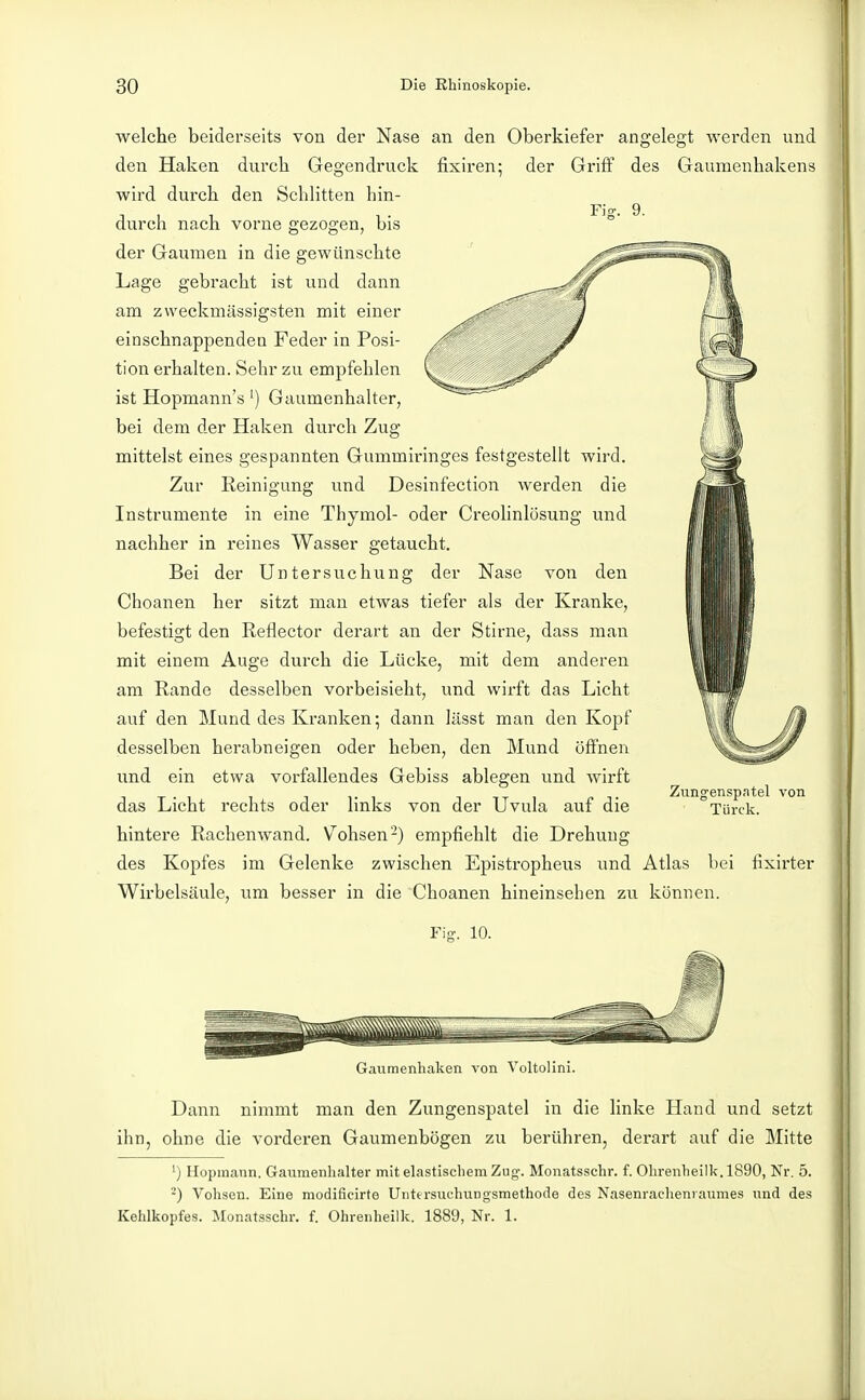 welche beiderseits von der Nase an den Oberkiefer angelegt werden und den Haken durch Gegendruck fixiren; der Gi'iff des Gaumenhakens wird durch den Schlitten hin- Fig. 9. durch nach vorne gezogen, bis der Gaumen in die gewünschte Lage gebracht ist und dann am zvveckmässigsten mit einer einschnappenden Feder in Posi- tion erhalten. Sehr zu empfehlen ist Hopmann's') Gaumenhalter, bei dem der Haken durch Zug- mittelst eines gespannten Gummiringes festgestellt wird. Zur Reinigung und Desinfection werden die Instrumente in eine Thymol- oder Creolinlösung und nachher in reines Wasser getaucht. Bei der Untersuchung der Nase von den Choanen her sitzt man etwas tiefer als der Kranke, befestigt den Reflector derart an der Stirne, dass man mit einem Auge durch die Lücke, mit dem anderen am Rande desselben vorbeisieht, und wirft das Licht auf den Mund des Kranken; dann lässt man den Kopf desselben herabneigen oder heben, den Mund öffnen und ein etwa vorfallendes Gebiss ablegen und wirft das Licht rechts oder links von der Uvula auf die hintere Rachenwand. V^ohsen-) empfiehlt die Drehung des Kopfes im Gelenke zwischen Epistropheus und Atlas bei fixirter Wirbelsäule, um besser in die Choanen hineinsehen zu können. Ziingenspntel von Türck. Gaiimenhaken von Voltolini. Dann nimmt man den Zungenspatel in die linke Hand und setzt ihn, ohne die vorderen Gaumenbögen zu berühren, derart auf die Mitte ') Hopinann, Gaumenhalter mit elastischem Zug-. Monatsschr. f. Ohrenheilk. 1890, Nr. 5. ') Vohsen. Eine modificirte Untersuchungsmethode des Nasenrachenraumes und des Kehlkopfes. Monatsschr. f. Ohrenheilk. 1889, Nr. 1.