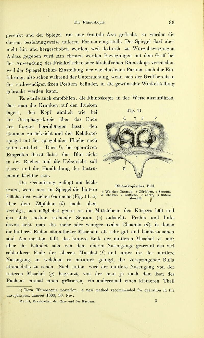 gesenkt und der Spiegel um eine frontale Axe gedreht, so werden die oberen, beziehungsweise unteren Partien eingestellt. Der Spiegel darf aber nicht hin und hergeschoben werden, weil dadurch zu Würgebewegungen Anlass gegeben wird. Am ehesten werden Bewegungen mit dem Griff bei der Anwendung des Fränkel'schen oder Michel'schen Rhinoskops vermieden, weil der Spiegel behufs Einstellung der verschiedenen Partien nach der Ein- führung, also schon während der Untersuchung, wenn sich der Griff bereits in der nothwendigen fixen Position befindet, in die gewünschte Winkelstellung gebracht werden kann. Es wurde auch empfohlen, die Rhinoskopie in der Weise auszuführen, dass man die Kranken auf den Rücken lagert, den Kopf ähnlich wie bei der Oesophagoskopie über das Ende des Lagers herabhängen lässt, den Gaumen zurückzieht und den Kehlkopf- spiegel mit der spiegelnden Fläche nach unten einführt— Dorn bei operativen Eingriffen fliesst dabei das Blut nicht in den Rachen und die üebersicht soll klarer und die Handhabung der Instru- mente leichter sein. Die Orientirung gelingt am leich- testen, wenn man im Spiegel die hintere Fläche des weichen Gaumens (Fig. 11, a) über dem Zäpfchen (b) nach oben verfolgt, sich möglichst genau an die Mittelebene des Körpers hält und das stets median stehende Septum (c) aufsucht. Rechts und links davon sieht man die mehr oder weniger ovalen Choanen (d), in denen die hinteren Enden sämmtlicher Muscheln oft sehr gut und leicht zu sehen sind. Am meisten fällt das hintere Ende der mittleren Muschel (e) auf; über ihr befindet sich von dem oberen Nasengange getrennt das viel schlankere Ende der oberen Muschel (f) und unter ihr der mittlere Nasengang, in welchem es mitunter gelingt, die vorspringende Bulla ethmoidalis zu sehen. Nach unten wird der mittlere Nasengang von der unteren Muschel (g) begrenzt, von der man je nach dem Bau des Rachens einmal einen grösseren, ein anderesmal einen kleineren Theil Rhinoskopisches Bild. a Weicher Gaumen, b Zäpfchen, c Septum. d Choane. e Mittlere, / obere, g untere Muschel. ß ') Dorn. Ehinoscopia posterior; a new method recommended for Operation in the nasopharynx. Laucet 1889, 30. Nov. Rethi. Krankheiten der Nase und des Hachens. 3