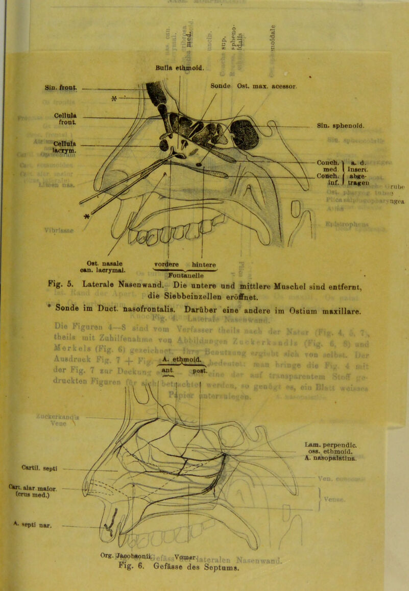 Ost. nasale can. laerymal. vordere hintere Fontanelle f ig. 5. Laterale Nasenwand. Die untere und mittlere Muschel sind entfernt, die Siebbeinzellen eröffnet. * Sonde im Duct. nasofrontalis. Darüber eine andere im Ostium maxillare. Die l'igaren 4—8 sind vom Verfasser theils theils mit Zuhilfenahme von Abbildun ~t. Merkels (Fig. 6j gezeichnet, ihr Br - Ausdruck 1' ■ 7 - A. ethmoid. der Fig. 7 zur I»:. ant post, druckten Figuren fü Zuckerkands cb der Kafut (Fig. 4. rerk.. ndl» (Fig. fi \ r.'«bt sich von weihst n au bnnge die Fig a; tr nsparentem Sif genügr e» eiu Bis t * Vene Um. perpendic. 088. ethmoid. A. nasopalatina. Cartil. septi alar maior (erns med.) septi nar. Ven. cw Org. Jaoobsonü. Vomer. fig. 6. Gefasse des Septums. Sin. front. Cellula front Cellula laorym. LÜnen nun. Vihrlssae B Sg ? - tF -. . ~ jj- , ff •§ Bulla ethmoid. Sonde Ost. max. aeessor. Sin. sphenold. Conch. \ a. d. med. 1 Insert. Conch. | ahge- inf. .1 tragen „ , ruhe < >sl. pli«ii j ■ g t ■) :,r'j ngea Eplstwph'