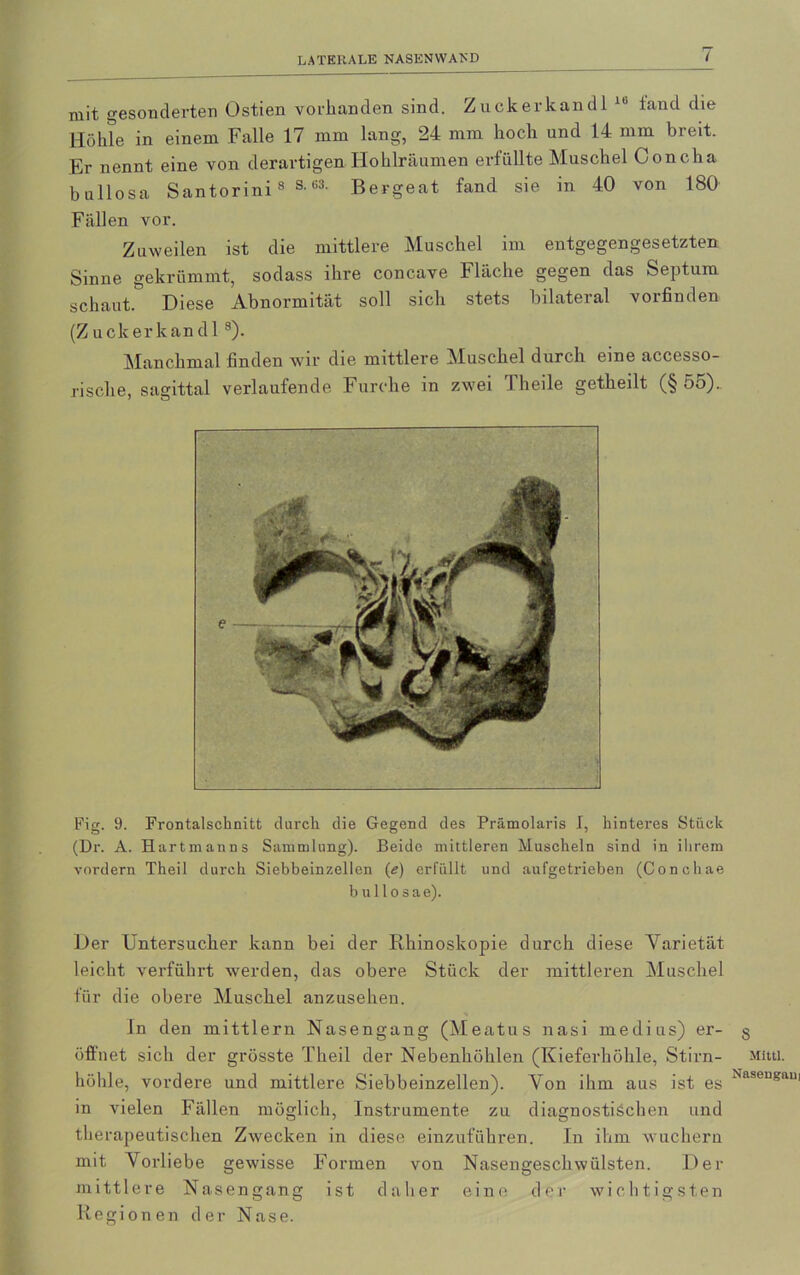 LATERALE NASENWAND mit gesonderten Ostien vorhanden sind. Zuckerkand l 10 tand die Höhle in einem Falle 17 mm lang, 24 mm hoch und 14 nun breit. Er nennt eine von derartigen Hohlräumen erfüllte Muschel Conclia bullosa Santorini8 s’ü3- Bergeat fand sie in 40 von 180 Fällen vor. Zuweilen ist die mittlere Muschel im entgegengesetzten Sinne gekrümmt, sodass ihre concave Fläche gegen das Septum schaut. Diese Abnormität soll sich stets bilateral vorfinden (Zuckerkandl 8). Manchmal finden wir die mittlere Muschel durch eine accesso- risclie, sagittal verlaufende Furche in zwei Theile getheilt (§ 5o). Fig. 9. Frontalschnitt durch die Gegend des Prämolaris I, hinteres Stück (Dr. A. Hart man ns Sammlung). Beide mittleren Muscheln sind in ihrem vordem Theil durch Siebbeinzellen (e) erfüllt und aufgetrieben (Conohae bullosae). Der Untersucher kann bei der Rhinoskopie durch diese Yarietät leicht verführt werden, das obere Stück der mittleren Muschel für die obere Muschel anzusehen. ln den mittlern Nasengang (Meatus nasi medius) er- öffnet sich der grösste Theil der Nebenhöhlen (Kieferhöhle, Stirn- höhle, vordere und mittlere Siebbeinzellen). Yon ihm aus ist es in vielen Fällen möglich, Instrumente zu diagnostischen und therapeutischen Zwecken in diese einzuführen. In ihm wuchern mit Vorliebe gewisse Formen von Nasengeschwülsten. Der mittlere Nasengang ist daher eine der wichtigsten Regionen der Nase. S Mittl. Nasengani