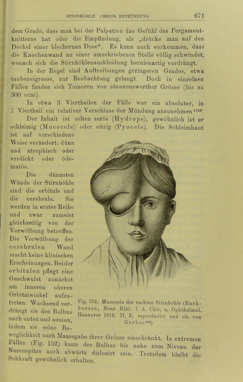 dem Grade, dass man bei der Palpation das Gefühl des Pergament- knitterns hat oder die Empfindung, als „drücke man auf den Deckel einer blechernen Dose“. Es kann auch Vorkommen, dass die Knochenwand an einer umschriebenen Stelle völlisr schwindet, wonach sich die Stirnhöhlenauskleidung hernienartig vordrängt. In der Regel sind Auftreibungen geringeren Grades, etwa taubeneigrosse, zur Beobachtung gelangt. Doch in einzelnen Fällen fanden sich Tumoren von staunenswerther Grösse (bis zu 1 300 ccm). matös. Die dünnsten Wände der Stirnhöhle sind die orbitale und die cerebrale. Sie werden in erster Reihe und zwar zumeist gleichzeitig von der Yorwölbung betroffen. Die Yorwölbung der cerebralen Wand macht keine klinischen Erscheinungen. Beider orbitalen pflegt eine Geschwulst zunächst am inneren oberen Orbitalwinkel aufzu- treten. Wachsend ver- drängt sie den Bulbus nach unten und aussen, indem sie seine Be- in etwa 3 Yiertheilen der Fälle war ein absoluter, in 1 Viertheil ein relativer Verschluss der Mündung anzunehmen 1529. Der Inhalt ist selten serös (Hydrops), gewöhnlich ist er schleimig (Mucocele) oder eitrig (Pyocele). Die Schleimhaut ist auf verschiedene Weise verändert: dünn und atrophisch oder verdickt oder öde- Fig. 152. Mucocele der rechten Stirnhöhle (Bark- hausen, Neue Bibi. f. d. Chir. u. Ophthalmol. Hannover 1819. II, 3; reproducirt und cit. von Gerber192). weghchkeit nach Maassgabe ihrer Grösse einschränkt. In extremen Villen (Fig. 152) kann der Bulbus bis nahe zum Niveau der Nasenspitze auch abwärts dislocirt sein. Trotzdem bleibt die Sehkraft gewöhnlich erhalten.