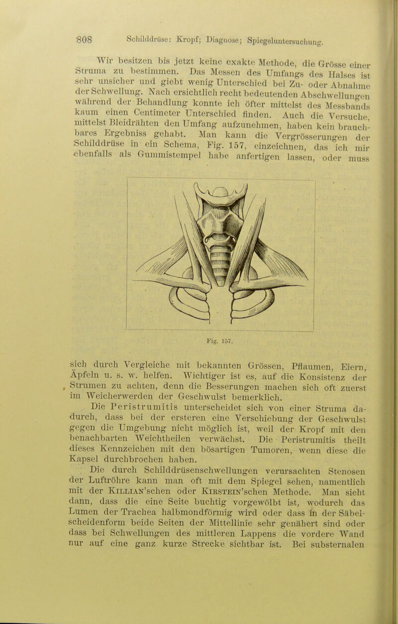 Wir besitzen bis jetzt keine exakte Methode, die Grösse emer Struma zu bestimmen. Das Messen des Umfangs des Halses ist sehr unsicher und giebt wenig Unterschied bei Zu- oder Abnahme der Schwellung. Nach ersichtlich recht bedeutenden Abschwellung(qi wäln-end der Behandlung konnte ich öfter mittelst des Messba^ids kaum emen Centimeter Unterschied finden. Auch die Versuche mittelst Bleidrähtcn den Umfang aufzunehmen, hal>en kein braucli- bares Ergebniss gehabt. Man kann die Vergrösserungen der Schilddrüse in ein Schema, Fig. 157, einzeichnen, das ich mii- .ebenfalls als Gummistempel habe anfertigen lassen, oder muss Fig. 157. sich durch Vergleiche mit bekannten Grössen, Pflaumen, Eiern, Äpfeln u. s. w. helfen. Wichtiger ist es, auf die Konsistenz der , Strumen zu achten, denn die Besserungen machen sich oft zuerst im Weicherwerdeu der Geschwulst bemerklich. Die Peristrumitis unterscheidet sich von einer Struma da- durch, dass bei der ersteren eine Verschiebung der Gesch^^-^llsr gegen die Umgebung nicht möglich ist, Aveil der Kropf mit den benachbarten Weichtheilen verwächst. Die Peristrumitis theilt dieses Kennzeichen mit den bösartigen Tumoren, wenn diese die Kapsel durchbrochen haben. Die durch Schilddrüsenschwellungcn verursachten Stenosen der Luftröhre kann man oft mit dem Spiegel sehen, namentlich mit der KiLLiAN'schen oder KmsTEm'schen Methode. Man sieht dann, dass die eine Seite buchtig vorgewölbt ist, wodurch das Lumen der Trachea halbmondförmig Avird oder dass in der Sftbei- scheidenform beide Seiten der Mittellinie sehr genähert sind oder dass bei SchAvellungen des mittleren Lappens die vordere Wand nur auf eine ganz kurze Strecke sichtbar ist. Bei substernalen