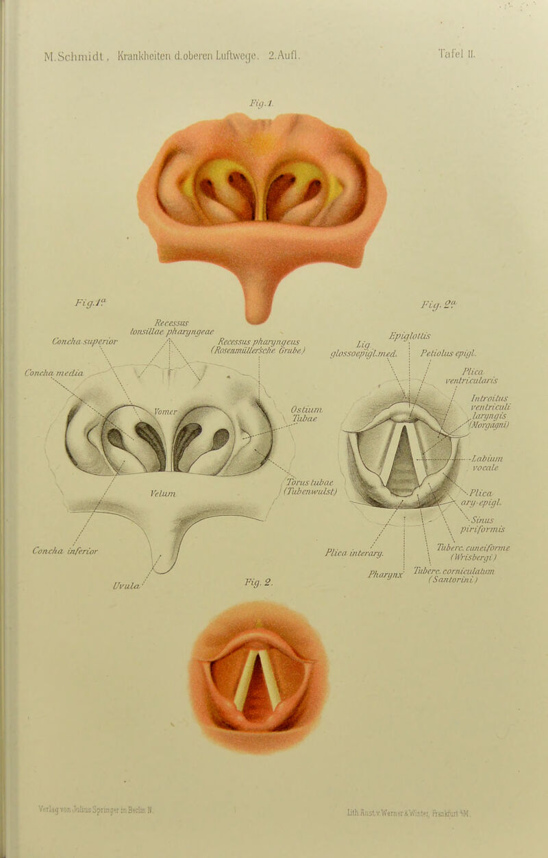 Talc'l II. Fig.l. Concha siiperior Concha media Recesstis loiLiiUac phiuyngeae Velum ConclM inferior Uvula.' Rccessiis pliaryngctis (Rpsunmällfrschr Onthe.) lig yLossoepigLmed. Fiy. 2?- Epiglollis Petiolus epiffl: Ostiuni Tiibae Tonis tubnc I (Tuhenwulst) Plica ventri.cularis Iiitroilus rciUriculi / laryngis ■{^ y ' (Morgagni) Labüim vocalc •■■Plica .an/epigl. \ '■Sinus : piriformis \ Tuberc. ciineiforme \ (Wrisbcrgi) Fig. 2. Plica interary. \ Phaninx- cornimlatiim ■ .jSpring'rinBeriir.H. Lith Anstv.Wem«!