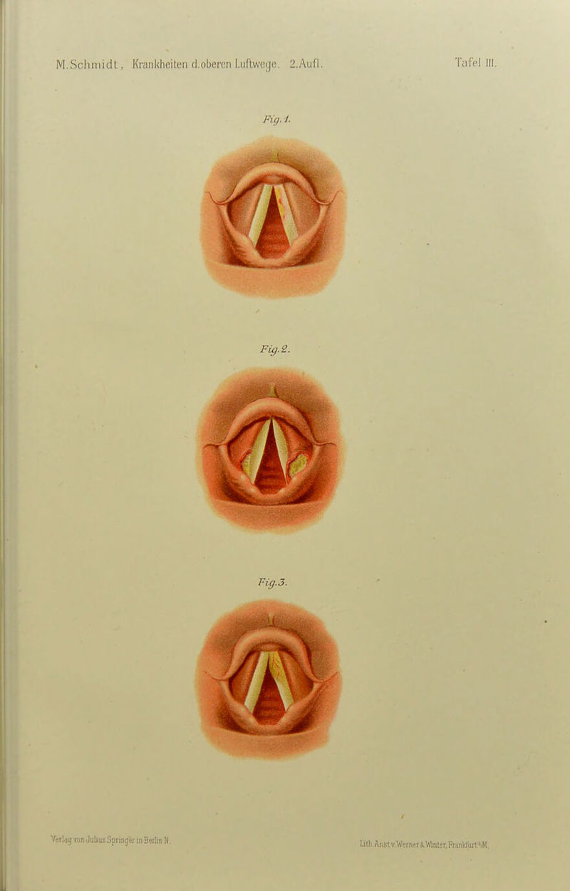 Fig.i. Fig. 2. Uth Anslv.WerneriWmter.FnrV/iirt^-M.