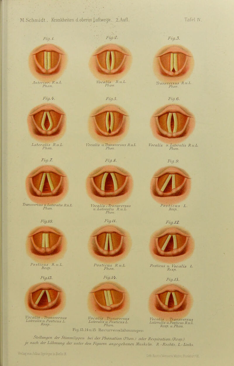 Tnui.u crstis ii.Lri/riri/is Ru.L Phon localis , Tnin.'i\-ersus ii.La/i'ra/ix R u.L. Phon Posti cus Res/t. FigJO. Fici.ll. Fuj.JS Po sliciix R. II L. Rf.sp. Ffg./.J. m l'ocali.i , Tran.'ivcr.iiis hdlcioh.-i II I'o.sliciis /,. Reafi. Posiicus R.n.L. Phon. Fig.Uj^. Vocrtli's . Trari.iver.siis Lillertili.i ii. Po.iliciis L. Phon. PiK-iliriui u. Vocalis L lil'Sfl. Pig. 1.5. Vociilis , Transi-i'r.ins /.ii/iTiili.s ii.Poslini.s R.II.I,. Kexji. U.Phon, I'ijj. I.'i.l'l-n l.'j RfMMiiTtMislolunniKj(-ii SleUimtßin ilfr Slimmlippni hei der Plioniilion ll'hou.i oder Rr.yiirritioii.IJie.sii.) (leh der Liihiniini/ der luiler den Fu/iireii ii,ii,rijcheiicn Mii.ykeln R Rechts. L.-Links.