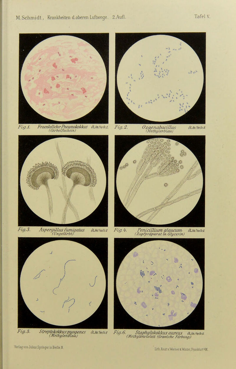 Fig.l. FraenkeJicherPnewnokokkus ÖUm.'/isOcs. Fig.2. Ozaenabacilbis öLM'AeOcs. (Carbolriichsui) (MethyUnbLau) Fig. 3. Aspergillus äunigaäis dUm.'/ii0c2 Fig.^. Pemcilliuni gLaucum ölmMsOcs. (Ungefärbt) (Ziipfpräparat tk Glycerin) Verlagvon JubusSpringerinBerlin H. • iith.Anstv.Wen.eriWmter,Franl<f.rtW..