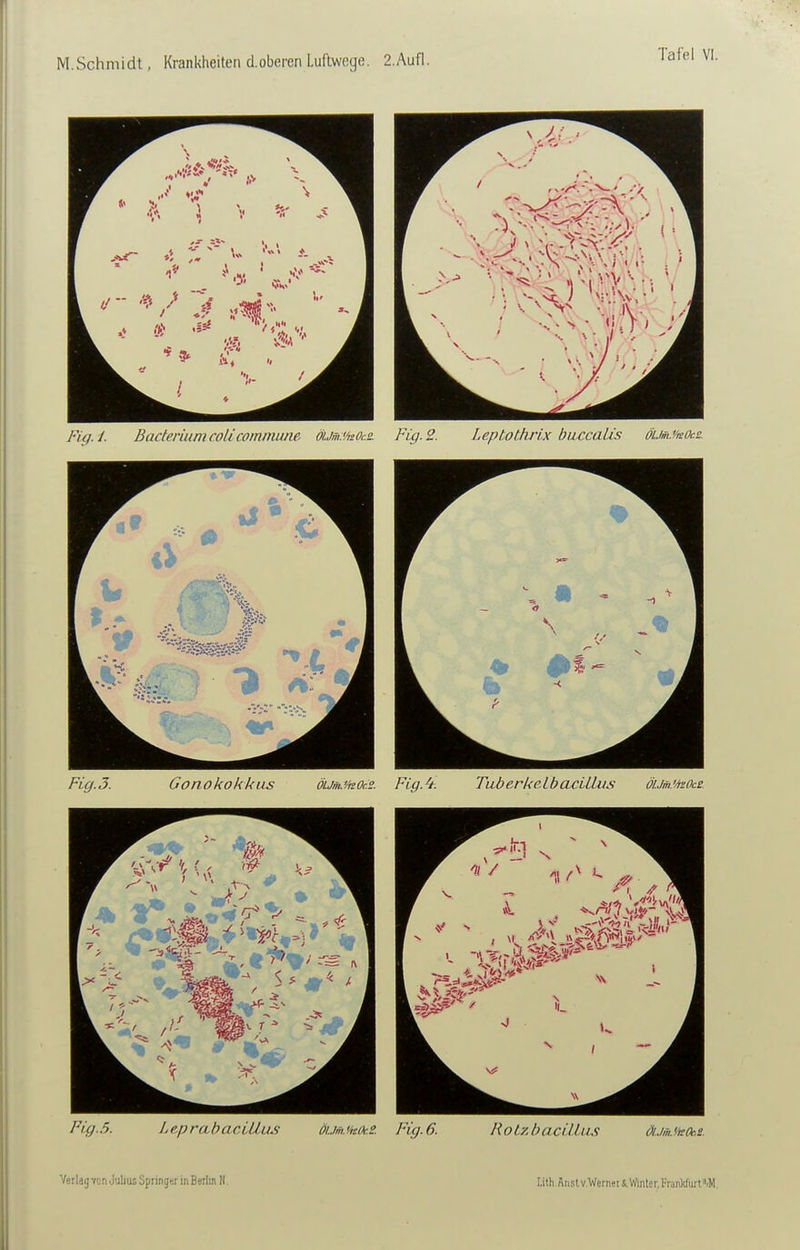 Fig.l. Baderium coli commune ömvisOcs. Fig. 2. Leptothrix buccalis öim^kOcd. Fig.3. Gonokokkus ÖLjm.t'itOce. Fig.^. Tuberl<elbacUliis öUmMsOcs. Fig.5. Le,pr(x.bacLllus öum.</,c0c.2. Fig.6. Roiy.baciLlus äJm.^i!(k.s