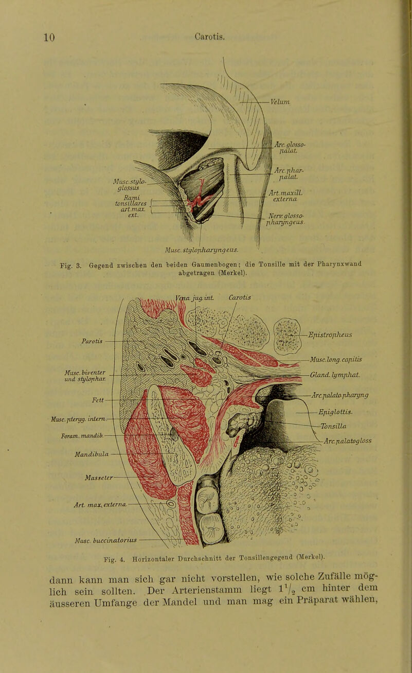 Muse. Fig. 4. Horizontaler Durchschnitt der Tonsillengegend (Merkel). dann kann man sich gar nicht vorstellen, wie solche Zufälle mög- lich sein sollten. Der Arterienstamm liegt IV2 cm hinter dem äusseren Umfange der Mandel und man mag ein Präparat wählen,