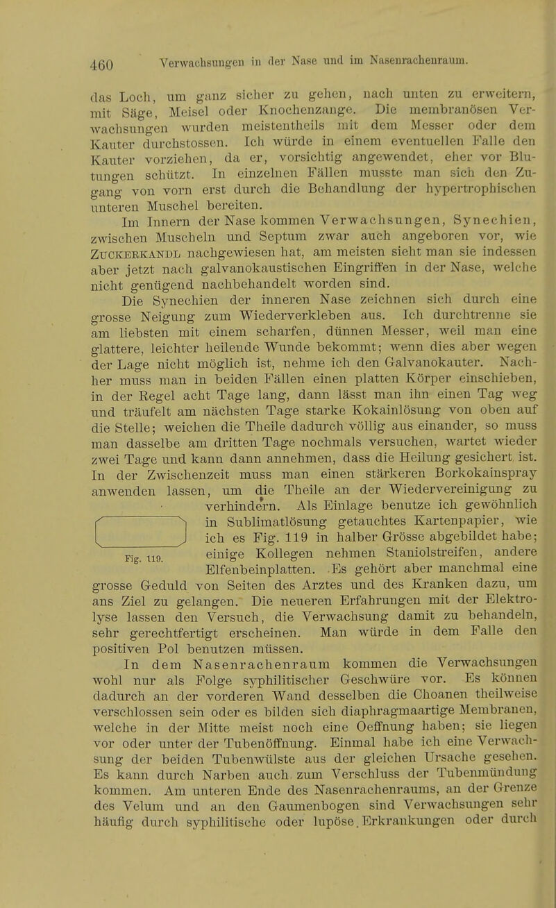 das Loch, um ganz sicher zu gehen, nach unten zu erweitern, mit Säge, Meisel oder Knochenzange. Die membranösen Ver- wachsungen wurden meistentheils mit dem Messer oder dem Kauter durchstossen. Ich würde in einem eventuellen Falle den Kauter vorziehen, da er, vorsichtig angewendet, eher vor Blu- tungen schützt. In einzelnen Fällen musste man sich den Zu- gang von vorn erst durch die Behandlung der hypertrophischen unteren Muschel bereiten. Im Innern der Nase kommen Verwachsungen, Synechien, zwischen Muscheln und Septum zwar auch angeboren vor, wie ZucKERKANDL nachgewiesen hat, am meisten sieht man sie indessen aber jetzt nach galvanokaustischen Eingriffen in der Nase, welche nicht genügend nachbehandelt worden sind. Die Synechien der inneren Nase zeichnen sich durch eine grosse Neigung zum Wiederverkleben aus. Ich durchtrenne sie am liebsten mit einem scharfen, dünnen Messer, weil man eine glattere, leichter heilende Wunde bekommt; wenn dies aber wegen der Lage nicht möglich ist, nehme ich den Galvanokauter. Nach- her muss man in beiden Fällen einen platten Körper einschieben, in der Regel acht Tage lang, dann lässt man ihn einen Tag ^veg und träufelt am nächsten Tage starke Kokainlösung von oben auf die Stelle; weichen die Theile dadurch völlig aus einander, so muss man dasselbe am dritten Tage nochmals versuchen, wartet wieder zwei Tage und kann dann annehmen, dass die Heilung gesichert ist. In der Zwischenzeit muss man einen stärkeren Borkokainspray anwenden lassen, um die Theile an der Wiedervereinigung zu verhindern. Als Einlage benutze ich gewöhnlich ^ in Sublimatlösung getauchtes Kartenpapier, wie J ich es Fig. 119 in halber Grösse abgebildet habe; Fig. 119. einige Kollegen nehmen Staniolstreifen, andere Elfenbeinplatten. Es gehört aber manchmal eine grosse Geduld von Seiten des Arztes und des Kranken dazu, um ans Ziel zu gelangen. Die neueren Erfahrungen mit der Elektro- lyse lassen den Versuch, die Verwachsung damit zu behandeln, sehr gerechtfertigt erscheinen. Man w^ürde in dem Falle den positiven Pol benutzen müssen. In dem Nasenrachenraum kommen die Verwachsungen wohl nur als Folge syphilitischer Geschwüre vor. Es können dadurch an der vorderen Wand desselben die Choanen theilweise verschlossen sein oder es bilden sich diaphragmaartige Membranen, welche in der Mitte meist noch eine Oeffnung haben; sie liegen vor oder unter der Tubenöffnung. Einmal habe ich eine Verwach- sung der beiden Tubenwülste aus der gleichen Ursache gesehen. Es kann durch Narben auch, zum Verschluss der Tubenmündung kommen. Am unteren Ende des Nasenrachenraums, an der Grenze des Velum und an den Gaumenbogen sind Verwachsungen sehr häufig durch syphilitische oder lupöse. Erkrankungen oder durch