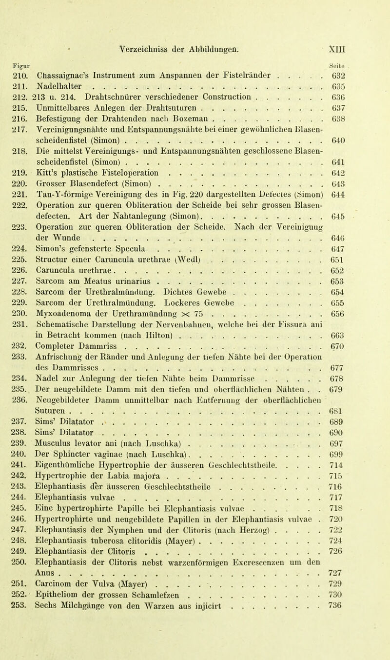 Figur Seite . 210. Chassaignac's Instrument zum Anspannen der Fistelränder 632 211. Nadelhalter 635 212. 213 u. 214. Drahtschnürer verschiedener Construction 636 215. Unmittelbares Anlegen der Drahtsuturen 637 216. Befestigung der Drahtenden nach Bozeman 638 217. Vereinigungsnähte und Entspannungsnähte bei einer gewöhnlichen Blasen- scheidenfistel (Simon) 640 218. Die mittelst Vereinigungs- und Entspannungsnähten geschlossene Blasen- scbeidenfistel (Simon) 641 219. Kitt's plastische Fisteloperation 642 220. Grosser Blasendefect (Simon) 643 221. Tau-Y-förmige Vereinigung des in Fig. 220 dargestellten Detectes (Simon) 644 222. Operation zur queren Obliteratiou der Scheide bei sehr grossen Blasen- defecten. Art der Nahtanlegung (Simon) 645 223. Operation zur queren Oblitcration der Scheide. Nach der Vereiuiguug der Wunde 646 224. Simon's gefensterte Specula 647 225. Structur einer Caruncula urethrae (Wedl) 651 226. Caruncula urethrae 652 227. Sarcom am Meatus urinarius 653 228. Sarcom der Urethralmümlung. Dichtes Gewebe . 654 229. Sarcom der Urethraimüuduug. Lockeres Gewebe 655 230. Myxoadenoma der Urethramündung x 75 656 231. Schematische Darstellung der Nervenbahnen, welche bei der Fissura ani in Betracht kommen (nach Hilton) 663 232. Completer Dammriss 670 233. Anfrischung der Ränder und Anlegung der tiefen Nähte bei der Operation des Dammrisses 677 234. Nadel zur Anlegung der tiefen Nähte beim Dammrisse 678 235. Der neugebildcte Damm mit den tiefen und oberflächlichen Nähten . . 679 236. Neugebildeter Damm unmittelbar nach Eutferuung der oberflächlichen Suturen 681 237. Sims' Dilatator 689 238. Sims' Dilatator 690 239. Musculus levator ani (nach Luschka) 697 240. Der Sphincter vaginae (nach Luschka) 699 241. Eigenthümliche Hypertrophie der äusseren Geschlechtstheile 714 242. Hypertrophie der Labia majora 715 243. Elephantiasis der äusseren Geschlechtstheile 716 244. Elephantiasis vulvae 717 245. Eine hypertrophirte Papille bei Elephantiasis vulvae 718 246. Hypertrophirte und neugebildete Papillen in der Elephantiasis vulvae . 720 247. Elephantiasis der Nymphen und der Clitoris (nach Herzog) 722 248. Elephantiasis tuberosa clitoridis (Mayer) 724 249. Elephantiasis der Clitoris 726 250. Elephantiasis der Clitoris nebst warzenförmigen Excrescenzen um den Anus , , 727 251. Carcinom der Vulva (Mayer) 729 252. Epitheliom der grossen Schamlefzen 730 253. Sechs Milchgänge von den Warzen aus injicirt 736