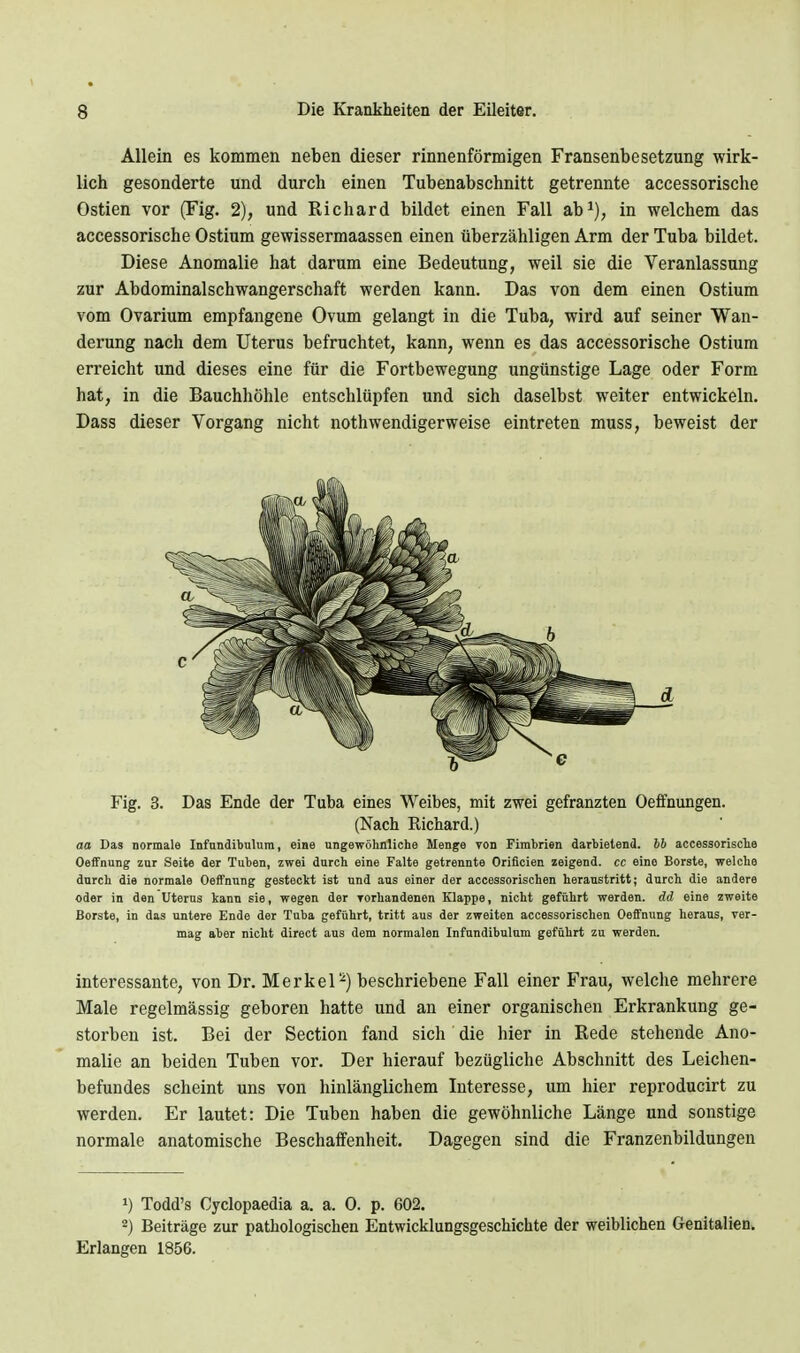 Allein es kommen neben dieser rinnenförmigen Fransenbesetzung wirk- lich gesonderte und durch einen Tubenabschnitt getrennte accessorische Ostien vor (Fig. 2), und Richard bildet einen Fall ab^), in welchem das accessorische Ostium gewissermaassen einen überzähligen Arm der Tuba bildet. Diese Anomalie hat darum eine Bedeutung, weil sie die Veranlassung zur Abdominalschwangerschaft werden kann. Das von dem einen Ostium vom Ovarium empfangene Ovum gelangt in die Tuba, wird auf seiner Wan- derung nach dem Uterus befruchtet, kann, wenn es das accessorische Ostium erreicht und dieses eine für die Fortbewegung ungünstige Lage oder Form hat, in die Bauchhöhle entschlüpfen und sich daselbst weiter entwickeln. Dass dieser Vorgang nicht nothwendigerweise eintreten muss, beweist der Fig. 3. Das Ende der Tuba eines Weibes, mit zwei gefranzten Oeffnungen. (Nach Richard.) aa Das normale Infundibulum, eiiie ungewöhnliche Menge von Fimbrien darbietend, hb accessorische Oeffnung zur Seite der Tuben, zwei durch eine Falte getrennte Orificien zeigend, cc eine Borste, welche durch die normale Oeffnung gesteckt ist und aus einer der accessorischen heraustritt; durch die andere oder in den Uterus kann sie, wegen der Torhandenen Klappe, nicht geführt werden, dd eine zweite Borste, in das untere Ende der Tuba geführt, tritt aus der zweiten accessorischen Oeffnung heraus, ver- mag aber nicht direct aus dem normalen Infundibulum geführt zu werden. interessante, von Dr. Merkel-) beschriebene Fall einer Frau, welche mehrere Male regelmässig geboren hatte und an einer organischen Erkrankung ge- storben ist. Bei der Section fand sich' die hier in Rede stehende Ano- malie an beiden Tuben vor. Der hierauf bezügliche Abschnitt des Leichen- befundes scheint uns von hinlänglichem Interesse, um hier reproducirt zu werden. Er lautet: Die Tuben haben die gewöhnliche Länge und sonstige normale anatomische Beschaffenheit. Dagegen sind die Franzenbildungen 1) Todd's Cyclopaedia a. a. 0. p. 602. 2) Beiträge zur pathologischen Entwicklungsgeschichte der weiblichen Genitalien. Erlangen 1856.