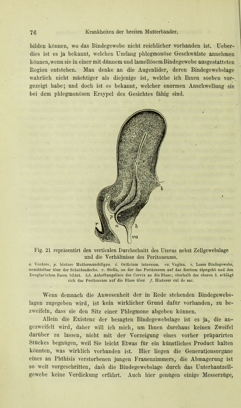bilden können, wo das Bindegewebe nicht reichlicher vorhanden ist. Ueber- dies ist es ja bekannt, welchen Umfang phlegmonöse Geschwülste annehmen können, wenn sie in einer mit dünnem und lamellösemBindegewebe ausgestatteten Eegion entstehen. Man denke an die Augenlider, deren Bindegewebslage wahrlich nicht mächtiger als diejenige ist, welöhe ich Ihnen soeben vor-, gezeigt habe; und doch ist es bekannt, welcher enormen Anschwellung sie bei dem phlegmonösen Ersypel des Gesichtes fähig sind. Fig. 21 repräsentirt den verticalen Durchschnitt des Uterus nebst Zellgcwebslage und die Verhältnisse des Peritoneums. a. Vordere, p. hintere Mnttermunäslippe. i. Orificium internum. va. Vagina, c. Loses Bindegewebe, unmittelbar über der Scbeidendecke. r. Stelle, an der das Peritonenm auf das Rectum üljergeht und den Douglas'schen Raum bildet, b.h. Änlieftungslinie des Cervix an die Blase; oberhalb des oberen b. schlägt sich das Peritoneum auf die Blase über. /. Hinterer cul da sac. Wenn demnach die Anwesenheit der in Rede stehenden Bindegewebs- lagen zugegeben wird, ist kein wirklicher Grund dafür vorhanden, zu be- zweifeln, dass sie den Sitz einer Phlegmone abgeben können. Allein die Existenz der besagten Bindegewebslage ist es ja, die an- gezweifelt wird, daher will ich mich, um Ihnen durchaus keinen Zweifel darüber zu lassen, nicht mit der Vorzeigung eines vorher präparirten Stückes begnügen, weil Sie leicht Etwas für ein künstliches Product halten könnten, was wirklich vorhanden ist. Hier liegen die Generationsorgane eines an Phthisis verstorbenen jungen Frauenzimmers, die Abmagerung ist so weit vorgeschritten, dass die Bindegewebslage durch das Unterhautzell- gewebe keine Verdickung erfährt. Auch hier genügen einige Messerzüge,