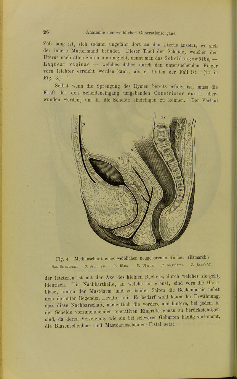 Zoll lang ist, sich sodann ungefälir dort an den Uterus ansetzt, wo sich der innere Muttermund befindet. Dieser Theil der Scheide, welcher den Uterus nach allen Seiten hin umgiebt, nennt man das Scheidengewölbe, Laquear vaginae — welches daher durch den untersuchenden Finger vorn leichter erreicht werden kann, als es hinten der Fall ist. (10 in Fig. 3.) ' Selbst wenn die Sprengung des Hymen bereits erfolgt ist, muss die Kraft des den Scheideneingang umgebenden Constrictor cunni über- wunden werden, um in die Scheide eindringen zu können. Der Verlauf Fig. 4. Medianschnitt eines weiblichen neugeborenen Kindes. (Esmarch.) O.s. Os sacrum. S. Syraplnyso. V. Blase. U. Uterus. R. Mastdarm. P. .BauchfeU. der letzteren ist mit der Axe des kleinen Beckens, durch welches sie geht, identisch. Die Nachbartheile, an welche sie grenzt, sind Yorn die Harn- blase, hinten der Mastdarm und zu beiden Seiten die Beckenfascie nebst dem darunter liegenden Levator ani. Es bedarf wolil kaum der Erwähnung, dass diese Nachbarschaft, namentlich die vordere und hintere, bei jedem in der Scheide vorzunehmenden operativen Eingriffe genau zu berücksichtigen Bind, da deren Verletzung, wie sie bei schweren Geburten häufig vorkommt, die Blasenscheiden- und Mastdarmscheiden-Fistel setzt.