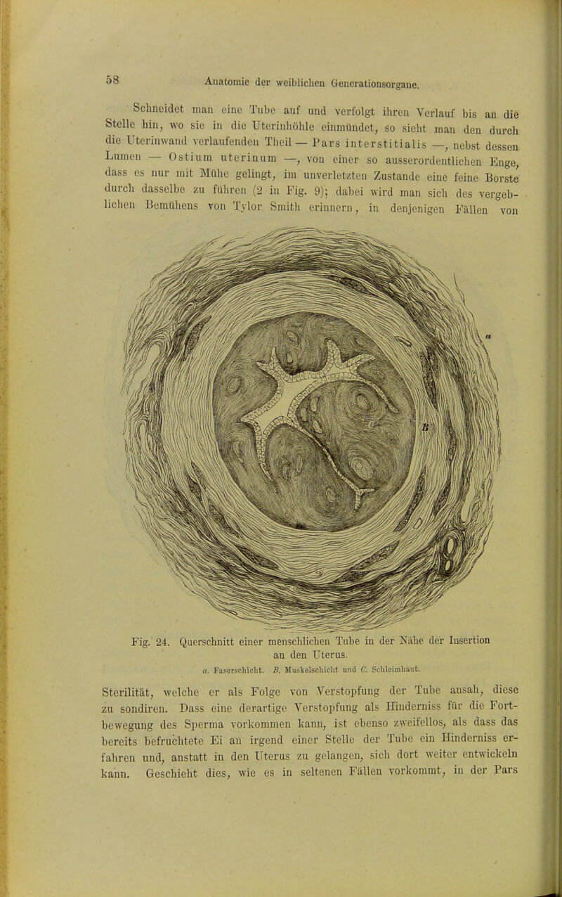 Sclinoidct man eine Tube auf und verfolgt ihren Verlauf bis an. die Stelle hin, wo sie in die Uterinhöhle einmündet, so sieht man den durch die Uterinwand verlaufenden Theil — Pars interstitialis —, nebst dessen Lumen — Ostium uteriuum —, von einer so ausserordentlichen Enge, dass es nur mit Mühe gelingt, im unverletzten Zustande eine feine Borste durch dasselbe zu führen (2 in Fig. 9); dabei wird man sich des vergeb- liclien Bemühens von T.vlor Smith erinnern, in denjenigen Fällen von Fig. 24. Querschnitt einer menschlichen Tube in der Nähe der Insertion an den Uterus. 0. Faserscliicht. B. Musltelschiclit und C. Scliloimliaut. Sterilität, wclclie er als Folge von Verstopfung der Tube ansah, diese zu sondiren. Dass eine derartige Verstopfung als Hinderniss für die Fort- bewegung des Sperma vorkommen kann, ist ebenso zweifellos, als dass das bereits befruchtete Ei an irgend einer Stelle der Tube ein Hinderniss er- fahren und, anstatt in den Uterus zu gelangen, sich dort weiter entwickeln kann. Geschieht dies, wie es in seltenen Fällen vorkommt, in der Pars