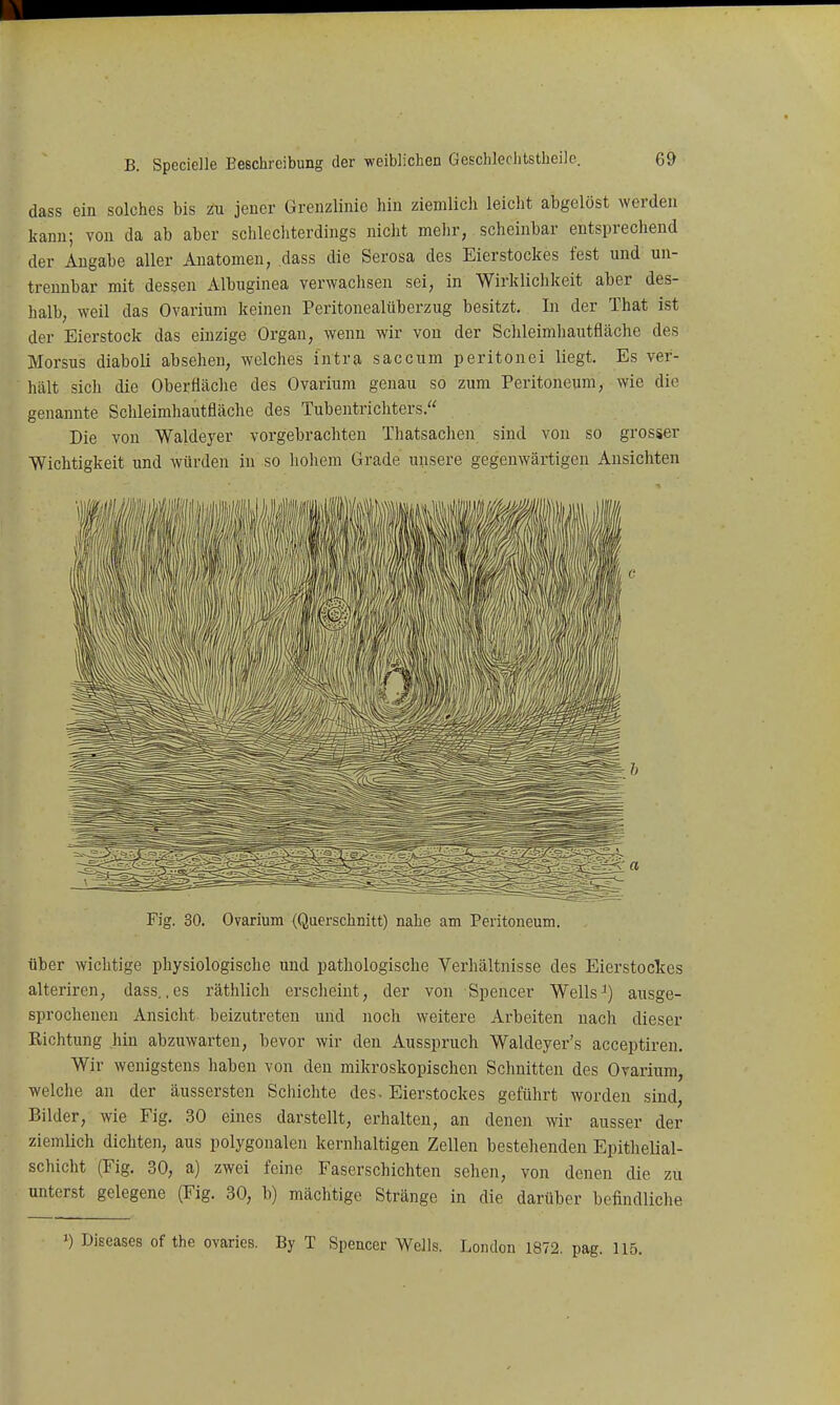 dass ein solches bis zu jener Grenzlinie hin ziemlieh leicht abgelöst werden kann; von da ab aber schlechterdings nicht mehr, scheinbar entsprechend der Angabe aller Anatomen, dass die Serosa des Eierstockes fest und un- trennbar mit dessen Albuginea verwachsen sei, in Wirklichkeit aber des- halb, weil das Ovarium keinen Peritonealüberzug besitzt. In der That ist der Eierstock das einzige Organ, wenn wir von der Schleimliautfläche des Morsus diaboli absehen, welches intra saccum peritonei liegt. Es ver- hält sich die Oberfläclie des Ovarium genau so zum Peritoneum, wie die genannte Schleimhautfläche des Tubentrichters. Die von Waldeyer vorgebrachten Thatsachen sind von so grosser Wichtigkeit und würden in so hohem Grade unsere gegenwärtigen Ansichten Fig. 30. Ovarium (Querschnitt) nahe am Peritoneum. über wichtige physiologische und pathologische Verhältnisse des Eierstockes alteriren, dass., es räthlich erscheint, der von Spencer Wells ^) ausge- sprochenen Ansicht beizutreten und nocli weitere Arbeiten nach dieser Richtung hin abzuwarten, bevor wir den Ausspruch Waldeyer's acceptiren. Wir wenigstens haben von den mikroskopischen Schnitten des Ovarium, welclie an der äussersten Schichte des- Eierstockes geführt worden sind, Bilder, wie Fig. 30 eines darstellt, erhalten, an denen wir ausser der ziemlich dichten, aus polygonalen kernhaltigen Zellen bestehenden Epithelial- schicht (Fig. 30, a) zwei feine Faserschichten sehen, von denen die zu Unterst gelegene (Fig. 30, b) mächtige Stränge in die darüber befindliche 1) Diseases of the ovaries. By T Spencer Wells, London 1872. pag. 115.