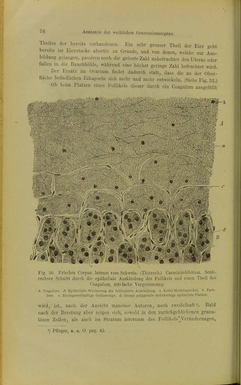 Theiles der bereits vorhandenen. Ein sehr grosser Theil der Eier geht bereits im Eierstocke abortiv zu Grunde, und von denen, welche zur Aus- bildung gelangen, passiren noch die grössteZalil unbefruchtet den Uterus oder fallen in die Bauchhöhle, während eine höchst geringe Zahl befruchtet wird.. Der Ersatz im Ovarium findet dadurch statt, dass die an der Ober- fläche befindlichen Eilcapseln sicli mehr und mein- entwickeln. (Siehe Fig. 32.). Ob beim Platzen eines Follikels dieser durch ein Ooagulum ausgefüllt Fig. 36. Frisches Corpus luteum vom Schwein. (Thiersch.) Carminimbibition. Senk- rechter Schnitt durch die epitheliale Auskleidung des Follikels und einen Theil des Coagulum, 400 fache Vergrösseruug. A. Coagulum. Ii. Epitheliale-Wucherung; der folliculareii Auskleidung, a. Eothe Blutkörperchen, h. Farb- lose, e. Uindegewebhaltige Gefässszüge. (l. Grosse polygonale mehrkernige epitheliale Platten. wird, ist, nach der Ansicht mancher Autoren, noch zweifelhaft'). Bald' nach der Berstung aber zeigen sich, sowolil in den zurückgebliebenen granu- lösen Zellen, als auch im Stratum internum des ,Follikel.s]jVeränderungen, 1) Pflüger, a. a. 0. pag. 42.