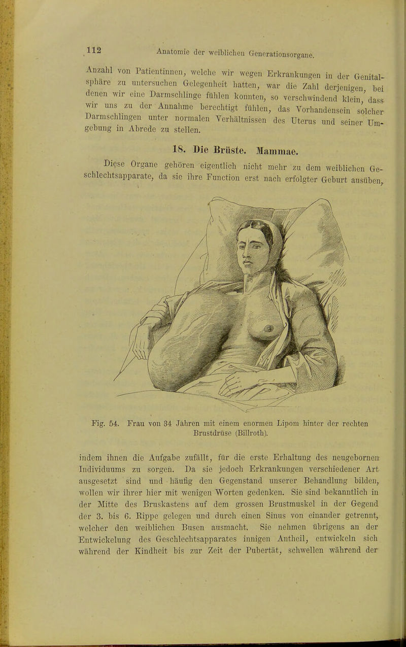 Anzahl von ratientinnen, welclie wir wegen Erkrankungen in der Genital Sphäre zu untersuclien Golcgenlieit liatten, war die Zahl derjenigen bei denen wir eine Darmschlinge fühlen konnten, so verschwindend klein ' dass wir uns zu der Annahme berechtigt fühlen, das Vorhandensein solcher Darmschlingen unter normalen Verhältnissen des Uterus und seiner Um- gebung in Abrede zu stellen. 18. Die Brüste. Mammae. Diese Organe gehören eigentlich nicht mehr zu dem weiblichen Ge- schlechtsapparate, da sie ihre Function erst nach erfolgter Geburt ausüben. Fig. 54. Frau von 34 Jahren mit einem enormen Lipom hinter der rechten Brustdrüse (Billroth). indem ihnen die Aufgabe zufällt, für die erste Erlialtung des neugeborneu Individuums zu sorgen. Da sie jedoch Erkrankungen verschiedener Art ausgesetzt sind und häufig den Gegenstand unserer Behandlung bilden, wollen wir ihrer hier mit wenigen Worten gedenken. Sie sind bekanntlich in der Mitte des Bruskastens auf dem grossen Brustmuskel in der Gegend der 3. bis 6. Rippe gelegen und durch einen Sinus von einander getrennt, welcher den weiblichen Busen ausmacht. Sic nehmen übrigens an der Entwickclung des Gcschlechtsapparates innigen Antheil, entwickeln sicli während der Kindheit bis zur Zeit der Pubertät, schwellen während der