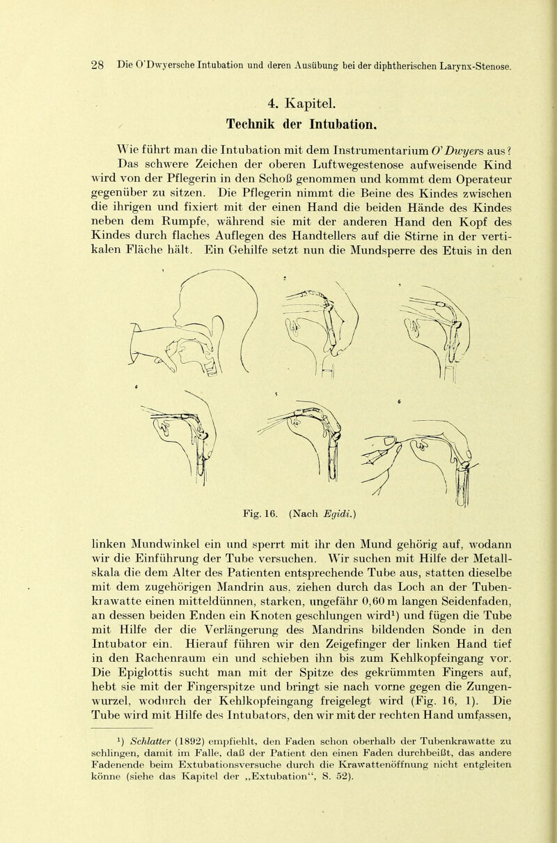 Wie führt man die Intubation mit dem Instrumentarium O'Dwyers aus? Das schwere Zeichen der oberen Luftwegestenose aufweisende Kind wird von der Pflegerin in den Schoß genommen und kommt dem Operateur gegenüber zu sitzen. Die Pflegerin nimmt die Beine des Kindes zwischen die ihrigen und fixiert mit der einen Hand die beiden Hände des Kindes neben dem Rumpfe, während sie mit der anderen Hand den Kopf des Kindes durch flaches Auflegen des Handtellers auf die Stirne in der verti- kalen Fläche hält. Ein Gehilfe setzt nun die Mundsperre des Etuis in den linken Mundwinkel ein und sperrt mit ihr den Mund gehörig auf, wodann wir die Einführung der Tube versuchen. Wir suchen mit Hilfe der Metall- skala die dem Alter des Patienten entsprechende Tube aus, statten dieselbe mit dem zugehörigen Mandrin aus. ziehen durch das Loch an der Tuben- krawatte einen mitteldünnen, starken, ungefähr 0,60 m langen Seidenfaden, an dessen beiden Enden ein Knoten geschlungen wird1) und fügen die Tube mit Hilfe der die Verlängerung des Mandrins bildenden Sonde in den Intubator ein. Hierauf führen wir den Zeigefinger der linken Hand tief in den Rachenraum ein und schieben ihn bis zum Kehlkopfeingang vor. Die Epiglottis sucht man mit der Spitze des gekrümmten Fingers auf, hebt sie mit der Fingerspitze und bringt sie nach vorne gegen die Zungen- wurzel, wodurch der Kehl köpf eingang freigelegt wird (Fig. 16, 1). Die Tube wird mit Hilfe des Intubators, den wir mit der rechten Hand umfassen, J) Schlatter (1892) empfiehlt, den Faden schon oberhalb der Tubenkrawatte zu schlingen, damit im Falle, daß der Patient den einen Faden durchbeißt, das andere Fadenende beim Extubationsversuche durch die Krawattenöffnung nicht entgleiten könne (siehe das Kapitel der „Extubation, S. 52). 4. Kapitel. Technik der Intubation.