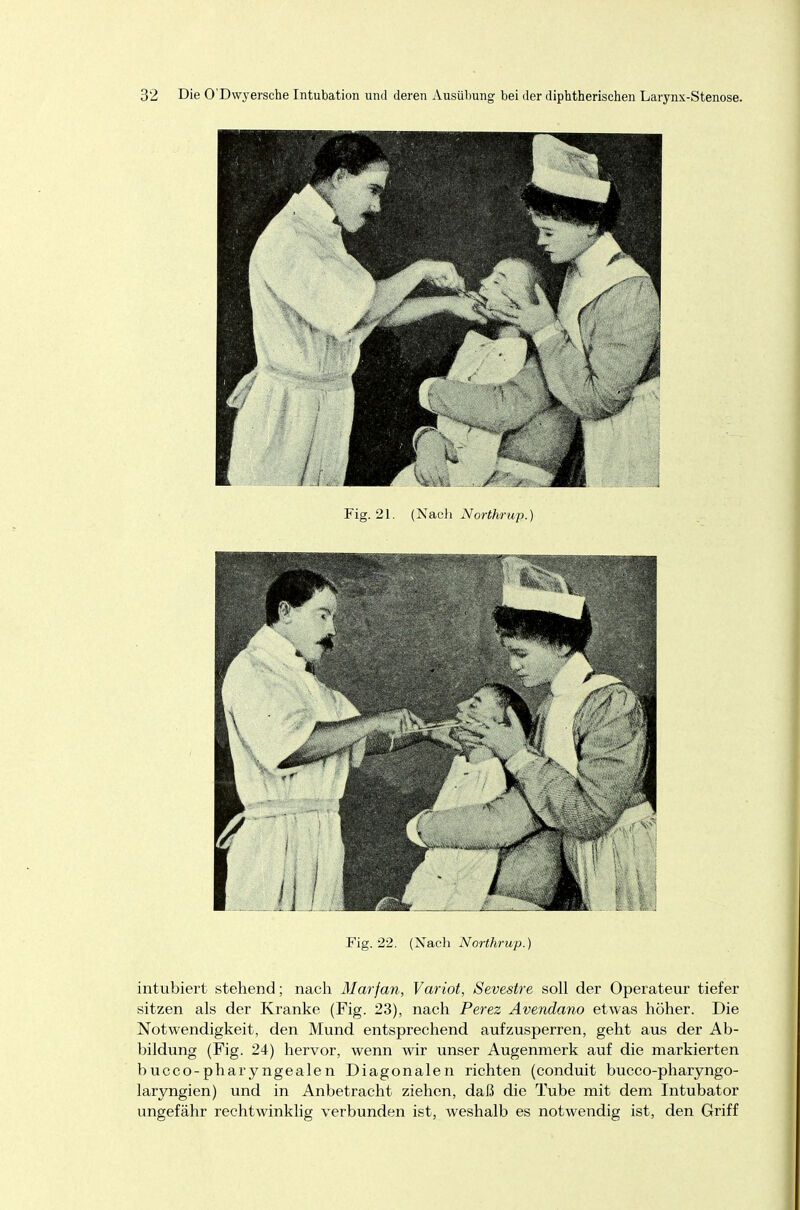 Fig. 21. (Nach Northrup.) Fig. 22. (Nach Northrup.) intubiert stehend; nach Marfan, Variot, Sevestre soll der Operateur tiefer sitzen als der Kranke (Fig. 23), nach Perez Avendano etwas höher. Die Notwendigkeit, den Mund entsprechend aufzusperren, geht aus der Ab- bildung (Fig. 24) hervor, wenn wir unser Augenmerk auf die markierten bucco-pharyngealen Diagonalen richten (conduit bucco-pharyngo- laryngien) und in Anbetracht ziehen, daß die Tube mit dem Intubator ungefähr rechtwinklig verbunden ist, weshalb es notwendig ist, den Griff