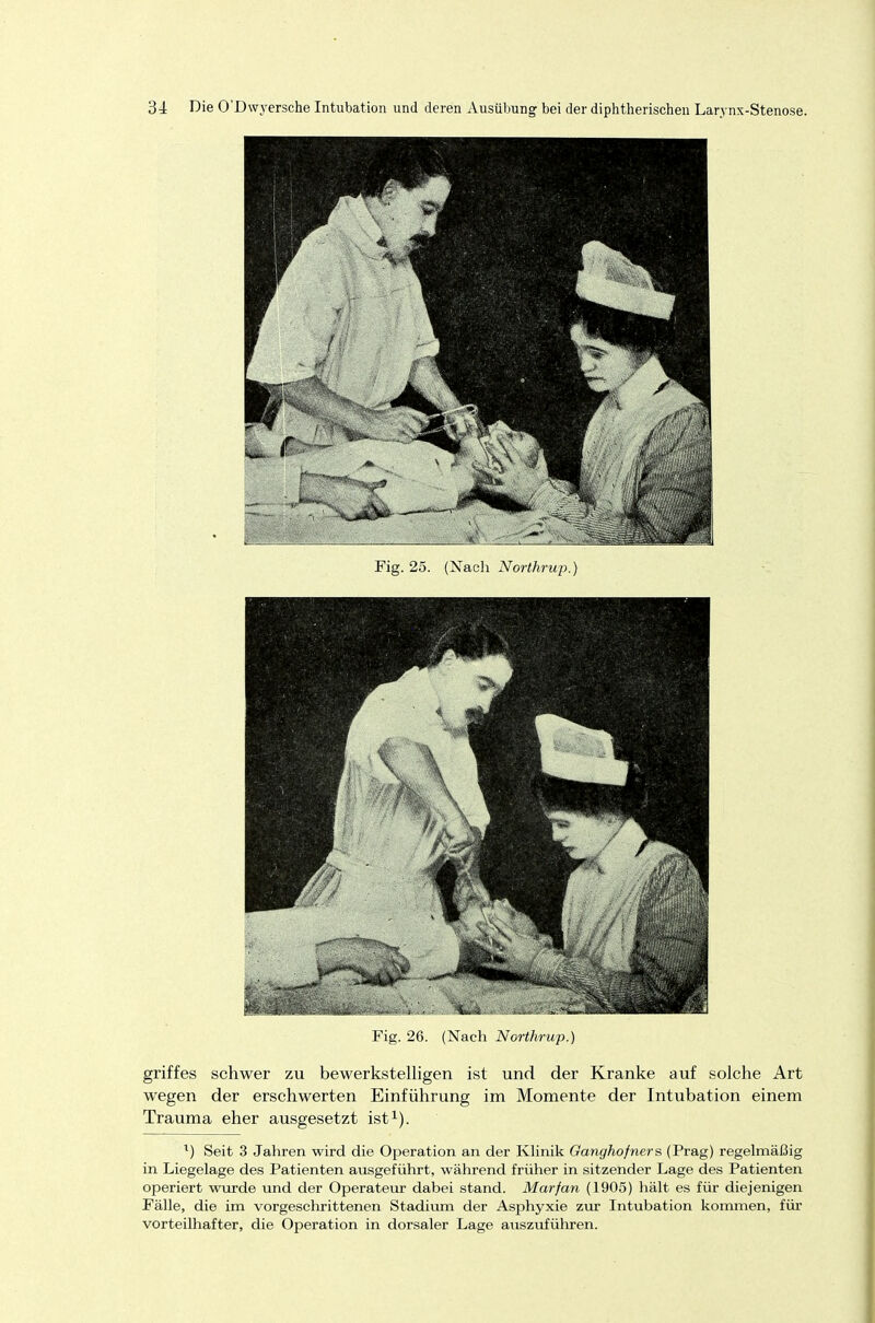 Fig. 25. (Nach Northrup.) Fig. 26. (Nach Northrup.) griffes schwer zu bewerkstelligen ist und der Kranke auf solche Art wegen der erschwerten Einführung im Momente der Intubation einem Trauma eher ausgesetzt ist1). x) Seit 3 Jahren wird die Operation an der Klinik Ganghofners (Prag) regelmäßig in Liegelage des Patienten ausgeführt, während früher in sitzender Lage des Patienten operiert wurde und der Operateur dabei stand. Marfan (1905) hält es für diejenigen Fälle, die im vorgeschrittenen Stadium der Asphyxie zur Intubation kommen, für vorteilhafter, die Operation in dorsaler Lage auszuführen.