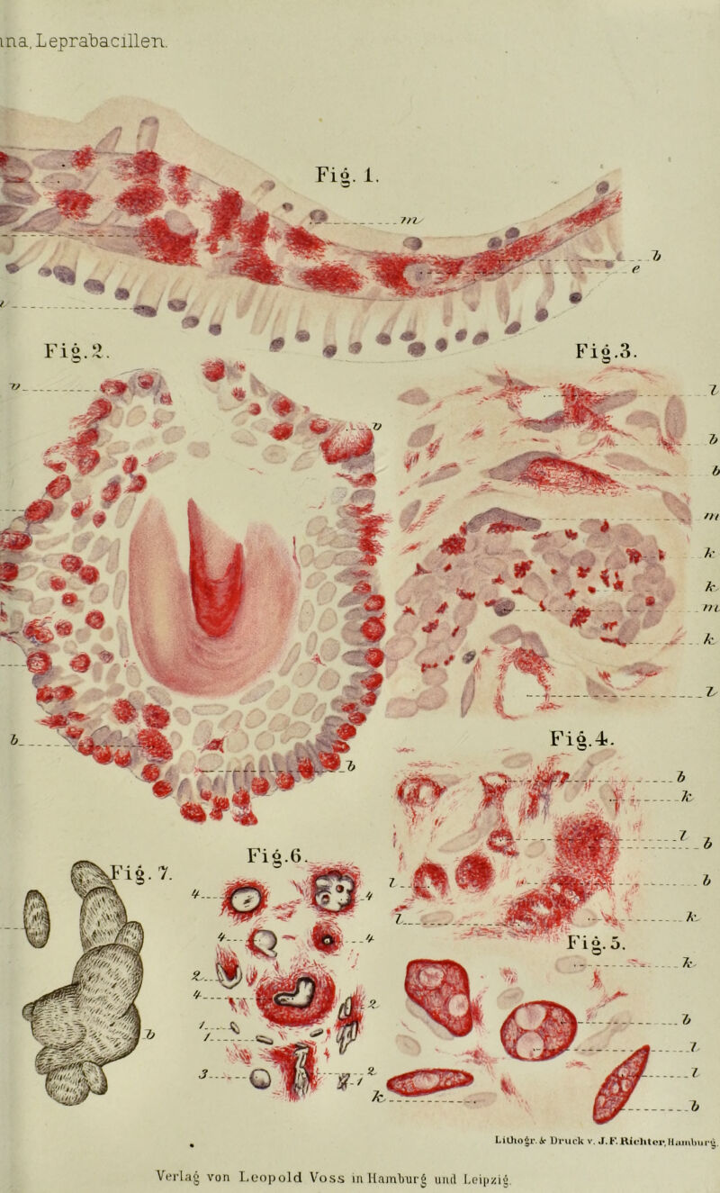 ina.Leprabacillen. Verlag von Leopold Voss in liambnr^ mul Leipzig.
