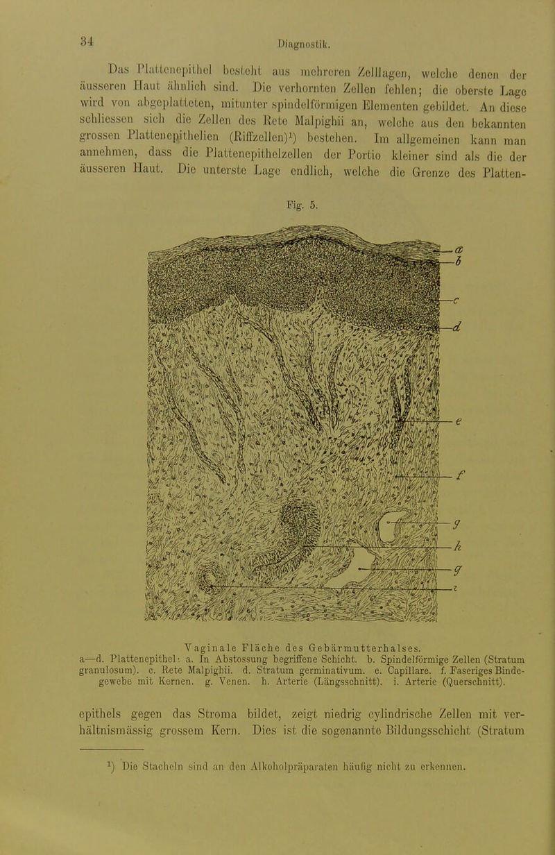 Das PlaiicnopiUiul bosLclit aus mehreren Zclllageii, welche denen der äusseren Haut ähnlich sind. Die verhornten Zellen fehlen; die oberste Lage wird von abgeplatteten, mitunter spindelförmigen Elementen gebildet. An diese schliessen sich die Zellen des Rete Malpighii an, welche aus den bekannten grossen Plattenciiithelien (Riffzellen)i) bestehen. Im allgemeinen kann man annehmen, dass die Plattenepithelzellen der Portio kleiner sind als die der äusseren Haut. Die unterste Lage endlich, welche die Grenze des Platten- Fig. 5. Vaginale Fläche des Gebärmutterhalses, a—d. Plattenepithel-, a. In Abstossung begriffene Schicht, b. Spindelförmige Zellen (Stratum granulosum). c. Rete Malpighii. d. Stratum germinativum. e. Capillare. f. Faseriges Binde- gewebe mit Kernen, g. Venen, h. Arterie (Längsschnitt), i. Arterie (Querschnitt). epithels gegen das Stroma bildet, zeigt niedrig cylindrische Zellen mit ver- hältnismässig grossem Kern. Dies i.st die sogenannte .Bildungsschicht (Stratum ■) Die Staclicln sind an den Alkoliolpräparalen häufig nicht zu erkennen.