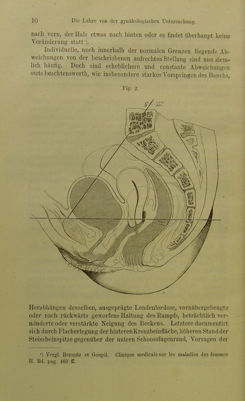 nach vorn, der Hals etwas nacli hinten oder es findet überhaupt keine Veränderung statt'). Individuelle, noch innerhalb der normalen Grenzen liegende Ab- weichungen von der beschriebenen aufrechten Stellung sind nun ziem- lich häufig. Doch sind erheblichere und constante Abweichungen stets beachtenswerth, wie insbesondere starkes Vorspringen des Bauchs, Fig. 2. Herabhängen desselben, ausgeprägte Lendenlordose, vornübergebeugte oder nach rückwärts geworfene Haltung des Rumpfs, beträchtlich ver- minderte oder verstärkte Neigung des Beckens. Letztere documentirt sich durch Flacherlegung der hinteren Kreuzbeinfläche, höheren Stand der Steissbeinspitze gegenüber der untern Schoossfugenrand, Vorragen der 1) Vergl. Bernutz et Goupil. Clinique medicale sur les maladies des femmes II. Bd. pag. 468 ff.