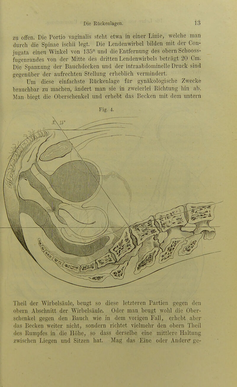 zu offen. Die Portio vaginalis steht etwa in einer Linie, welche man durch die Spinae ischii legt. Die Lendenwirbel bilden mit der Con- jugata einen Winkel von 135*' und die Entfernung des obern Schooss- fugenrandes von der Mitte des dritten Lendenwirbels beträgt 20 Cm. Die Spannung der Bauchdecken und der intraabdominelle Druck sind gegenüber der aufrechten Stellung erheblich vermindert. Um diese einfachste Eückenlage für gynäkologische Zwecke brauchbar zu machen, ändert man sie in zweierlei Richtung hin ab. Man biegt die Oberschenkel und erhebt das Becken mit dem untern Fig. 4. Theil der Wirbelsäule, beugt so diese letzteren Partien gegen den obern Abschnitt der Wirbelsäule. Oder man beugt wohl die Ober- schenkel gegen den Bauch wie in dem vorigen Fall, erhebt aber das Becken weiter nicht, sondern richtet vielmehr den obern Tlicil des Rumpfes in die Höhe, so dass derselbe eine mittlere Haltung zwischen Liegen und Sitzen hat. Mag das Eine oder Anderer ge-