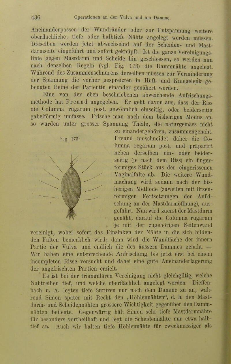 Fig. 173. Aneinanderpassen der Wundränder oder zur Entspannung weitere oberflächliche, tiefe oder halbtiefe Nähte angelegt werden müssen. Dieselben werden jetzt abwechselnd auf der Scheiden- und Mast- darmseite eingeführt und sofort geknüpft. Ist die ganze Vereinigungs- linie gegen Mastdarm und Scheide hin geschlossen, so werden nun nach denselben Regeln (vgl. Fig. 173) die Dammnähte angelegt. Während des Zusammenschnürens derselben müssen zur Verminderung der Spannung die vorher gespreizten in Hüft- und Kniegelerik ge- beugten Beine der Patientin einander genähert werden. Eine von der eben beschriebenen abweichende Anfrischungs- methode hat Freund angegeben. Er geht davon aus, dass der Riss die Columna rugarum post. gewöhnlich einseitig, oder beiderseitig gabelförmig umfasse. Frische man nach dem bisherigen Modus an, so würden unter grosser Spannung Theile, die naturgemäss nicht zu einandergehören, zusammengenäht. Freund umschneidet daher die Co- lumna regarum post. und präparirt neben derselben ein- oder beider- seitig (je nach dem Riss) ein finger- förmiges Stück aus der eingerissenen Vaginalfalte ab. Die weitere Wund- machung wird sodann nach der bis- herigen Methode (zuweilen mit litzen- förmigen Fortsetzungen der Anfri- schung an der Mastdarmöffnuug), aus- geführt. Nun wird zuerst der Mastdarm genäht, darauf die Columna rugarum je mit der zugehörigen Seitenwand vereinigt, wobei sofort das Einsinken der Nähte in die sich bilden- den Falten bemerklich wird; dann wird die Wundfläche der inueru Partie der Vulva und endlich die des äussern Dammes genäht. — Wir haben eine entsprechende Anfrischung bis jetzt erst bei einem incompleten Risse versucht und dabei eine gute Aneinanderlagerung der angefrischten Partien erzielt. Es ist bei der triangulären Vereinigung nicht gleichgiltig, welche Nahtreihen tief, und welche oberflächlich angelegt werden. Dieffen- bach u. A. legten tiefe Suturen nur nach dem Damme zu an, wäh- rend Simon später mit Recht den „Höhlennähten, d. h. den Mast- darm- und Scheidennähten grössere Wichtigkeit gegenüber den Damm- Bähten beilegte. Gegenwärtig hält Simon sehr tiefe Mastdarmnähte für besonders vortheilhaft und legt die Scheidennähte nur etwa halb- tief an. Auch wir halten tiefe Höhlennähte für zweckmässiger als