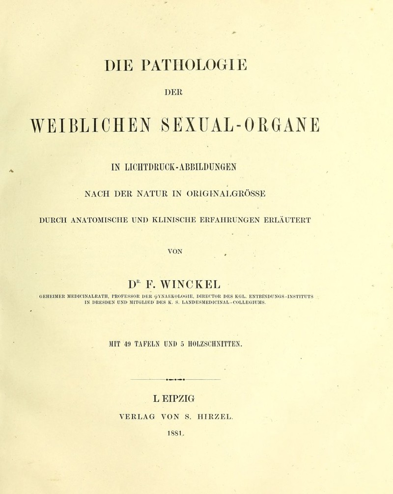 DIE PATHOLOGIE DER WEIBLICHEN SEXUAL-ORGANE IN LICHTDRUCK-ABBILDUNGEN NACH DER NATUR IN ORIGINALGRÖSSE DURCH ANATOMISCHE UND KLINISCHE ERFAHRUNGEN ERLÄUTERT VON D F. WINCKEL GEHEIMEE MEDICINALRATH, l'EOFESSOR DER UYNAKKOLOGIE, DIRECTOR DES KGL. ENTBlNDUNGS-INSTITUTS IN DRESDEN UND MITGLIED DES K. S. LANDESMEDICINAL - COLLEGIUMS. MIT 49 TAFELN UND 5 HOLZSCHNITTEN. L EIPZIG VERLAG VON S. HIRZEL. 1881,.