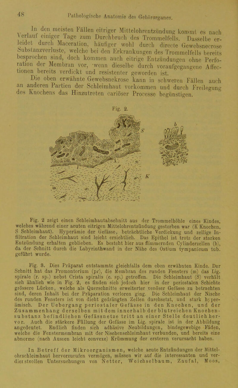 n (Ion meisten Fällen eitriger Mittelohrentzündung kommt es nach crlaul einiger läge zum Durchbruch des Trommelfells. Dasselbe er- leidet durch Maccration, häufiger wohl durch dirccte Gewebsnecrose öubstanzverluste, welche bei den Erkrankungen des Trommelfells bereits besprochen sind, doch kommen auch eitrige Entzündungen ohne Perfo- ration der Membran vor, -wenn dieselbe durch voraufgegangene Atfec- tionen bereits verdickt und resistenter geworden ist. Die oben erwähnte Gewebsnekrosc kann in schweren Fällen auch an anderen Partien der Schleimhaut Vorkommen und durch Freilegung des Knochens das Hinzutreten cariöser Processe begünstigen. Fig. 2 zeigt einen Schleimhautabschnitt aus der Trommelhöhle eines Kindes, welches während einer acuten eitrigen Mittelohrentzündung gestorben war (K Knochen, S Schleimhaut). Hyperämie der Gefässe, beträchtliche Verdickung und zellige In- filtration der Schleimhaut sind leicht ersichtlich. Das Epithel ist trotz der starken Entzündung erhalten geblieben. Es besteht hier aus flimmernden Cylinderzellen (b), da der Schnitt durch die Labyrinthwand in der Nähe des Ostium tympanicum tub. geführt wurde. Fig. 3. Dies Präparat entstammte gleichfalls dem eben erwähnten Kinde. Der Schnitt hat das Promontorium (pr), die Membran des runden Fensters (m) das Lig. spirale (r. sp.) nebst Crista spiralis (c. sp.) getroffen. Die Schleimhaut (S) verhält sich ähnlich wie in Fig. 2, es finden sich jedoch hier in der periostalen Schichte grössere Lücken, welche als Querschnitte erweiterter venöser Gefässe zu betrachten sind, deren Inhalt bei der Präparation verloren ging. Die Schleimhaut der Nische des runden Fensters ist von dicht gedrängten Zellen durchsetzt, und stark hyper- ämisch. Der Uebergang periostaler Gefässe in den Knochen, und der Zusammenhang derselben mit dem innerhalb der blutreichen Knochen- substanz befindlichen Gefässnetze tritt an einer Stelle deutlich her- vor. Auch die stärkere Füllung der Gefässe im Lig. spirale ist in der Abbildung angedeutet. Endlich finden sich adhäsive Neubildungen, bindegewebige Fäden, welche die Fenstermembran mit der Nischenschleimhaut verbunden, und bereits eine abnorme (nach Aussen leicht convexe) Krümmung der ersteren verursacht haben. In Betreff der Mikroorganismen, welche acute Entzündungen der Mittel- ohrschleimhaut hervorzurufen vermögen, müssen wir auf die interessanten und ver- dicrstvollen Untersuchungen von Netter, Weichselbaum, Zaufal, Moos,