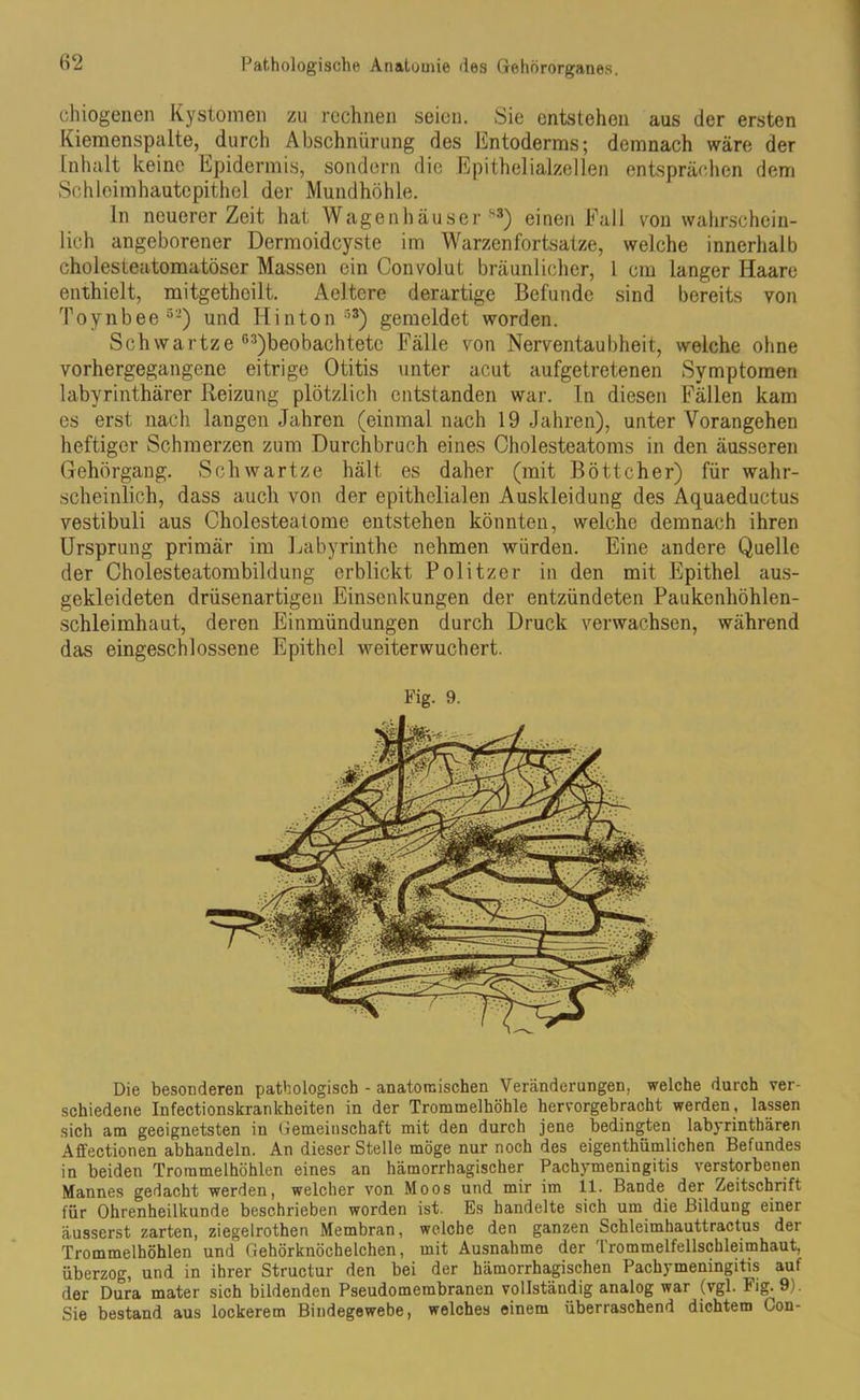 chiogenen Kystomen zu rechnen seien. Sie entstehen aus der ersten Kiemenspalte, durch Abschnürung des Entoderms; demnach wäre der Inhalt keine Epidermis, sondern die Epithelialzellen entsprächen dem Schleimhautepithel der Mundhöhle. ln neuerer Zeit hat Wagenhäuser''3) einen Fall von wahrschein- lich angeborener Dermoidcyste im Warzenfortsatze, welche innerhalb cholesteatomatöser Massen ein Convolut bräunlicher, l cm langer Haare enthielt, mitgetheilt. Aeltere derartige Befunde sind bereits von Toynbee52) und Hinton53) gemeldet worden. Schwartze f,3)beobachtetc Fälle von Nerventaubheit, welche ohne vorhergegangenc eitrige Otitis unter acut aufgetretenen Symptomen labyrinthärer Reizung plötzlich entstanden war. In diesen Fällen kam es erst nach langen Jahren (einmal nach 19 Jahren), unter Vorangehen heftiger Schmerzen zum Durchbruch eines Cholesteatoms in den äusseren Gehörgang. Schwartze hält es daher (mit Böttcher) für wahr- scheinlich, dass auch von der epithelialen Auskleidung des Aquaeductus vestibuli aus Cholesteatome entstehen könnten, welche demnach ihren Ursprung primär im Labyrinthe nehmen würden. Eine andere Quelle der Cholesteatombildung erblickt Politzer in den mit Epithel aus- gekleideten drüsenartigen Einsenkungen der entzündeten Paukenhöhlen- schleimhaut, deren Einmündungen durch Druck verwachsen, während das eingeschlossene Epithel weiterwuchert. Fig. 9. Die besonderen pathologisch - anatomischen Veränderungen, welche durch ver- schiedene Infectionskrankheiten in der Trommelhöhle hervorgebracht werden, lassen sich am geeignetsten in Gemeinschaft mit den durch jene bedingten labyrintbären Affectionen abhandeln. An dieser Stelle möge nur noch des eigenthiimlichen Befundes in beiden Trommelhöhlen eines an hämorrhagischer Pachymeningitis verstorbenen Mannes gedacht werden, welcher von Moos und mir im il. Bande der Zeitschrift für Ohrenheilkunde beschrieben worden ist. Es handelte sich um die Bildung einer äusserst zarten, ziegelrothen Membran, welche den ganzen Schleimhauttractus der Trommelhöhlen und Gehörknöchelchen, mit Ausnahme der Trommelfellschleimhaut, überzog, und in ihrer Structur den bei der hämorrhagischen Pachymeningitis auf der Dura mater sich bildenden Pseudomembranen vollständig analog war (vgl. Fig. 9). Sie bestand aus lockerem Bindegewebe, welches einem überraschend dichtem Gon-