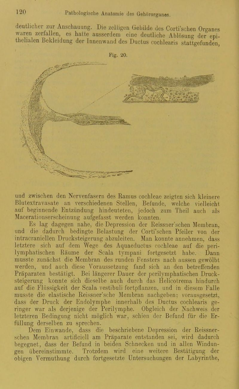 deutlicher zur Anschauung. Die zelligen Gebilde des Corti’schen Organes waren zerfallen, es hatte ausserdem eine deutliche Ablösung der epi- thelialen Bekleidung der Innenwand des Ductus cochlearis stattgefunden, Fig. 20. und zwischen den Nervenfasern des Ramus cochleae zeigten sich kleinere Blutextravasate an verschiedenen Stellen, Befunde, welche vielleicht auf beginnende Entzündung hindeuteten, jedoch zum Theil auch als Macerationserscheinung aufgefasst werden konnten. Es lag dagegen nahe, die Depression der Reissner'sehen Membran, und die dadurch bedingte Belastung der Corti’schen Pfeiler von der intracraniellen Drucksteigerung abzuleiten. Man konnte annehmen, dass letztere sich auf dem Wege des Aquaeductus cochleae auf die peri- lymphatischen Räume der Scala tympani fortgesetzt habe. Dann musste zunächst die Membran des runden Fensters nach aussen gewölbt werden, und auch diese Voraussetzung fand sich an den betreffenden Präparaten bestätigt. Bei längerer Dauer der perilymphatischen Druck- steigerung konnte sich dieselbe auch durch das Helicotrema hindurch auf die Flüssigkeit der Scala vestibuli fortpflanzen, und in diesem Falle musste die elastische Reissner’sche Membran nachgeben; vorausgesetzt, dass der Druck der Endolymphe innerhalb des Ductus cochlearis ge- ringer war als derjenige der Perilymphe. Obgleich der Nachweis der letzteren Bedingung nicht möglich war, schien der Befund für die Er- füllung derselben zu sprechen. Dem Ein wände, dass die beschriebene Depression der Reissner- schen Membran artificiell am Präparate entstanden sei, wird dadurch begegnet, dass der Befund in beiden Schnecken und in allen Windun- gen übereinstimmte. Trotzdem wird eine weitere Bestätigung der obigen Vermuthung durch fortgesetzte Untersuchungen der Labyrinthe,