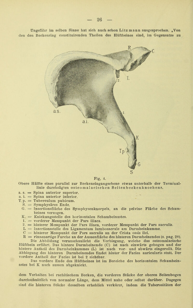 Ungefähr im selben Sinne hat sich auch schon Litz mann ausgesprochen. „Von den den Beckenring constituirenden Theilen des Hüftbeines sind, im Gegensatze zu Fig. 4. Obere Hälfte eines parallel zur Beckeneingangsebene etwas unterhalb der Terminal- linie durchsägten osteomalacischen Seitenbeckenknochens. a. s. = Spina anterior superior. ^ ' a, i. = Spina anterior inferior. T. p. = Tuberculum pubicum. S. = Symphysäres Ende. G. = Jnsertionsfläehe des Symphysenknorpels, an die pelvine Fläche des Scham- beines verzogen. K. = Knickungsstelle des horizontalen Schambeinastes. 1. = vorderer Messpunkt der Pars iliaca. 2. = hinterer Messpunkt der Pars iliaca, vorderer Messpunkt der Pars saeralis. L = Insertionsstelle des Ligamentum lumbosacrale am Darmbeinkamme. C = hinterer Messpunkt der Pars saeralis an der Crista ossis ilei. R = rinnenartige Furche an der Aussenfläche des hinteren Darmbeinendes (s. pag. 28). Die Abbildung veranschaulicht die Verbiegung, welche das osteomalacische Hüftbein erfährt. Das hintere Darmbeinende (C) ist nach einwärts gebogen und der hintere Antheil des Darmbeinkammes (L) ist nach vor- und abwärts eingerollt. Die Abbiegung des hinteren Darmbeinendes findet hinter der Facies auricularis statt. Der vordere Antheil der Facies ist bei 2 sichtbar. Das vordere Ende des Hüftbeines ist im Bereiche des horizontalen Schambein- astes bei K nach aussen abgeknickt. dem Verhalten bei rachitischem Becken, die vorderen Stücke der oberen Seitenbogen durchschnittlich von normaler Länge, dem Mittel nahe oder selbst darüber. Dagegen sind die hinteren Stücke desselben erheblich verkürzt, indem die Tuberositäten der