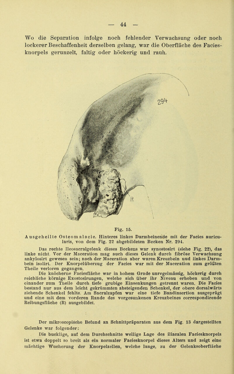 Wo die Separation infolge noch fehlender Verwachsung oder noch lockerer Beschaffenheit derselben gelang, war die Oberfläche des Facies- knorpels gerunzelt, faltig oder höckerig und rauh. Fig. 15. Ausgeheilte Osteomalacie. Hinteres linkes Darmbeinende mit der Facies auricu- laris, von dem Fig. 22 abgebildeten Becken Nr. 294. Das rechte Ileosacralgelenk dieses Beckens war synostosirt (siehe Fig. 22), das linke nicht. Vor der Maceration mag auch dieses Gelenk durch fibröse Verwachsung ankylosirt gewesen sein; nach der Maceration aber waren Kreuzbein und linkes Darm- bein isolirt. Der Knorpelüberzug der Facies war mit der Maceration zum größten Theile verloren gegangen. Die knöcherne Faciesfläche war in hohem Grade unregelmässig, höckerig durch reichliche körnige Exostosirungen, welche sich über ihr Niveau erhoben und von einander zum Theile durch tiefe grubige Einsenkungen getrennt waren. Die Facies bestand nur aus dem leicht gekrümmten absteigenden Schenkel, der obere dorsalwärts ziehende Schenkel fehlte. Am Sacralzapfen war eine tiefe Bandinsertion ausgeprägt und eine mit dem vorderen Rande des vorgesunkenen Kreuzbeines correspondirende Reibungsfläche (R) ausgebildet. Der mikroscopische Befund an Schnittpräparaten aus dem Fig. 13 dargestellten Gelenke war folgender: Die bucklige, auf dem Durchschnitte wellige Lage des iliacalen Faciesknorpels ist etwa doppelt so breit als ein normaler Faciesknorpel dieses Alters und zeigt eine mächtige Wucherung der Knorpelzellen, welche lange, zu der Gelenksoberfläche