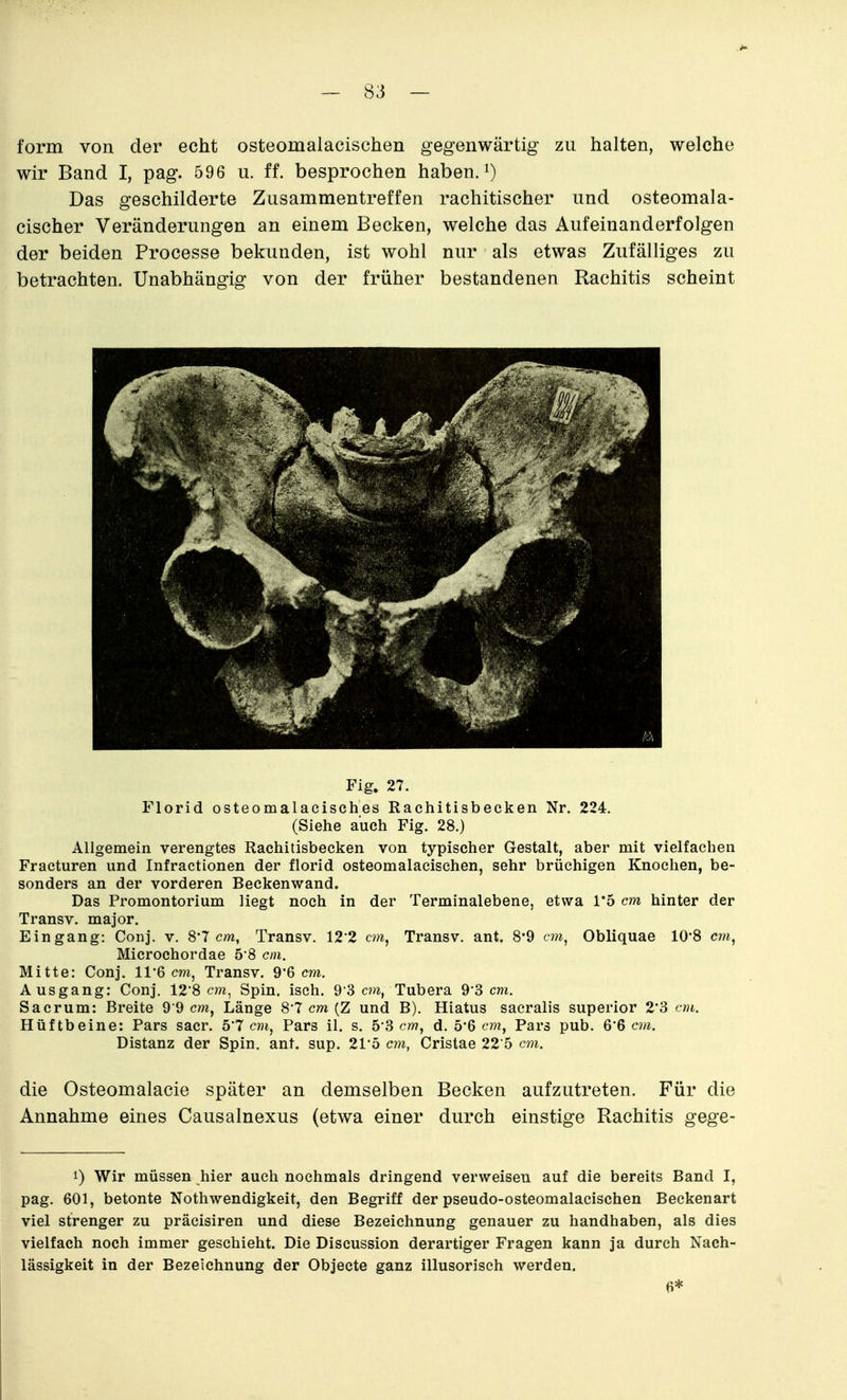 form von der echt osteomalaeischen gegenwärtig zu halten, welche wir Band I, pag. 596 u. ff. besprochen haben, Das geschilderte Zusammentreffen rachitischer und osteomala- cischer Veränderungen an einem Becken, welche das Aufeinanderfolgen der beiden Processe bekunden, ist wohl nur als etwas Zufälliges zu betrachten. Unabhängig von der früher bestandenen Rachitis scheint Fig. 27. Florid osteomalacisehes Rachitisbecken Nr. 224. (Siehe auch Fig. 28.) Allgemein verengtes Rachitisbecken von typischer Gestalt, aber mit vielfachen Fraeturen und Infractionen der florid osteomalaeischen, sehr brüchigen Knochen, be- sonders an der vorderen Beckenwand. Das Promontorium liegt noch in der Terminalebene, etwa 1*5 cm hinter der Transv. major. Eingang: Conj. v. 8'7 cw, Transv. 122 cm, Transv. ant. 8*9 cm^ Obliquae lO'S m, Microchordae 5 8 cm. Mitte: Conj. 11 6 cm, Transv. 9'6 cm. Ausgang: Conj. 12*8 c?w, Spin. isch. 9'3 cm, Tubera 9*3 cm. Sacrum: Breite 9 9 cm, Länge 8*7 cw (Z und B). Hiatus saeralis superior 2*3 cm. Hüftbeine: Pars sacr. 5'7 cm, Pars il. s. 6'3 cm, d. 5*6 cm. Pars pub. 6*6 cm. Distanz der Spin. ant. sup. 215 cm, Cristae 22 5 cm. die Osteomalacie später an demselben Becken aufzutreten. Für die Annahme eines Causalnexus (etwa einer durch einstige Rachitis gege- 1) Wir müssen hier auch nochmals dringend verweisen auf die bereits Band I, pag. 601, betonte Nothwendigkeit, den Begriff der pseudo-osteomalacischen Beckenart viel strenger zu präcisiren und diese Bezeichnung genauer zu handhaben, als dies vielfach noch immer geschieht. Die Discussion derartiger Fragen kann ja durch Nach- lässigkeit in der Bezeichnung der Objecte ganz illusorisch werden. 6*