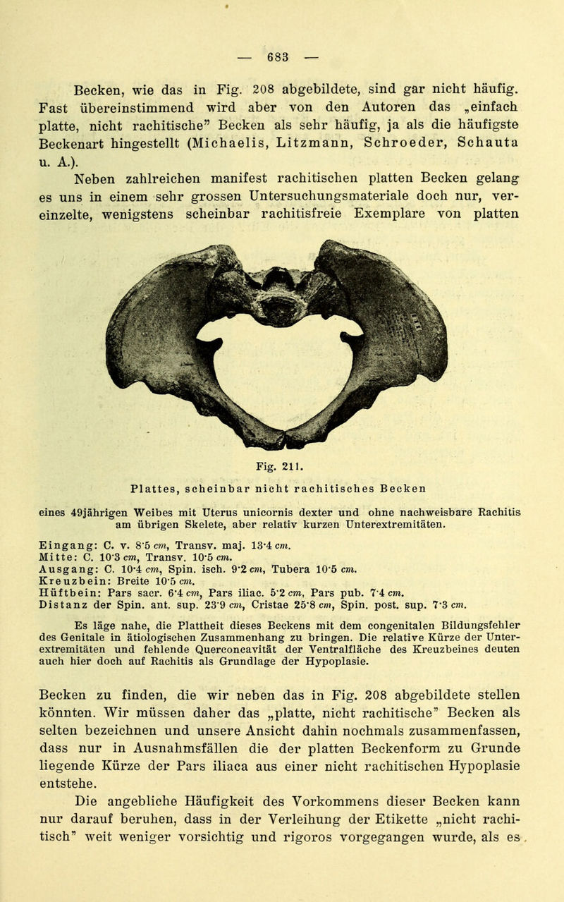 Becken, wie das in Fig. 208 abgebildete, sind gar nicht häufig. Fast übereinstimmend wird aber von den Autoren das „einfach platte, nicht rachitische Becken als sehr häufig, ja als die häufigste Beckenart hingestellt (Michaelis, Litzmann, Schroeder, Schauta u. A.). Neben zahlreichen manifest rachitischen platten Becken gelang es uns in einem sehr grossen Untersuchungsmateriale doch nur, ver- einzelte, wenigstens scheinbar rachitisfreie Exemplare von platten Fig. 211. Plattes, scheinbar nicht rachitisches Becken eines 49iährigen Weibes mit Uterus unicornis dexter und ohne nachweisbare Rachitis am übrigen Skelete, aber relativ kurzen Unterextremitäten. Eingang: C. v. 8'5 cm, Transv. maj. 13*4 cm. Mitte: C. 10-3 cw, Transv. 10*5 cm. Ausgang: C. 10'4 cm, Spin. isch. 9*2 cm, Tubera 10*5 cm. Kreuzbein: Breite 10*5 c?3i. Hüftbein: Pars sacr. 6*4 cm, Pars iliac. 52 cm, Pars pub. 7 4 cm. Distanz der Spin, ant, sup. 23'9 cm, Cristae 25*8 cm, Spin. post. sup. 7*3 cm. Es läge nahe, die Plattheit dieses Beckens mit dem congenitalen Bildungsfehler des Genitale in ätiologischen Zusammenhang zu bringen. Die relative Kürze der Unter- extremitäten und fehlende Querconcavität der Ventralfiäche des Kreuzbeines deuten auch hier doch auf Rachitis als Grundlage der Hypoplasie. Becken zu finden, die wir neben das in Fig. 208 abgebildete stellen könnten. Wir müssen daher das „platte, nicht rachitische Becken als selten bezeichnen und unsere Ansicht dahin nochmals zusammenfassen, dass nur in Ausnahmsfällen die der platten Beckenform zu Grunde liegende Kürze der Pars iliaca aus einer nicht rachitischen Hypoplasie entstehe. Die angebliche Häufigkeit des Vorkommens dieser Becken kann nur darauf beruhen, dass in der Verleihung der Etikette „nicht rachi- tisch weit weniger vorsichtig und rigoros vorgegangen wurde, als es