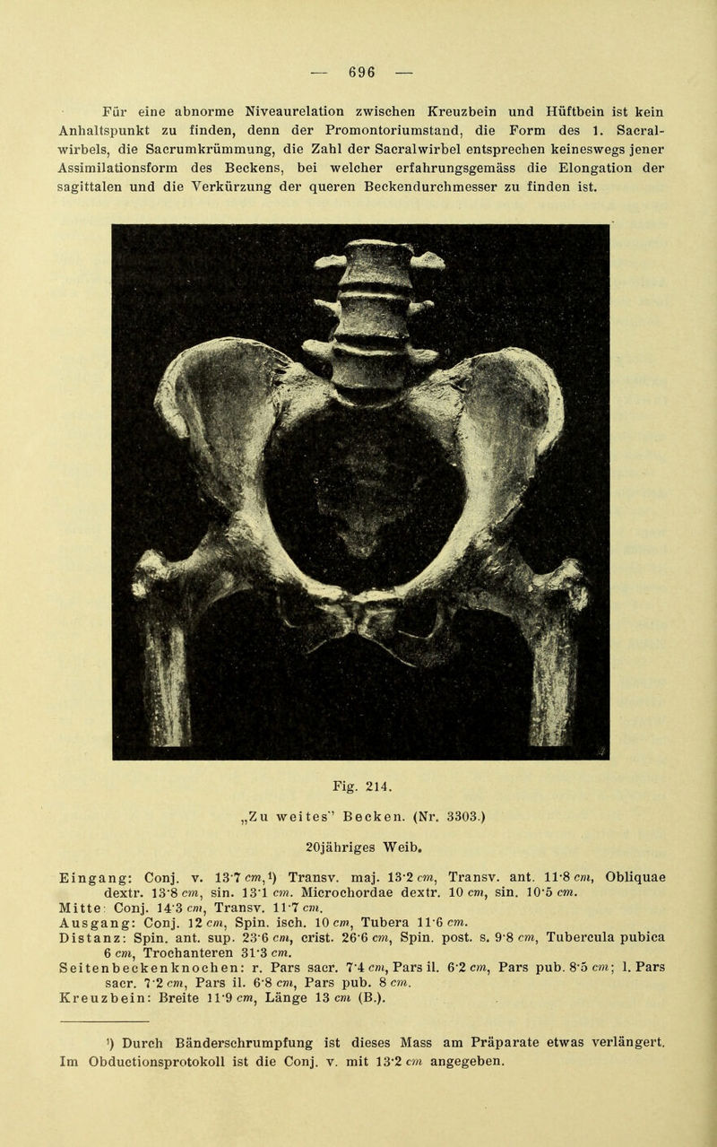Für eine abnorme Niveaurelation zwischen Kreuzbein und Hüftbein ist kein Anhaltspunkt zu finden, denn der Promontoriumstand, die Form des 1. Sacral- wirbels, die Sacrumkrümmung, die Zahl der Sacralwirbel entsprechen keineswegs jener Assimilationsform des Beckens, bei welcher erfahrungsgemäss die Elongation der sagittalen und die Verkürzung der queren Beckendurchmesser zu finden ist. Fig. 214. „Zu weites*' Becken. (Nr. 3303.) 20jähriges Weib. Eingang: Conj. v. 13 7 cm,i) Transv. maj. 13'2 cm, Transv. ant. 11-8 cm, Obliquae dextr. 138cw, sin. 131 c?n. Microchordae dextr. 10 cm, sin. 10'6 cm. Mitte: Conj. 143cnj, Transv. 117 cm. Ausgang: Conj, 12 cm, Spin. isch. 10 cm, Tubera 11*6 cm. Distanz: Spin. ant. sup. 23'6 cm, crist. 26*6 cm, Spin. post. s. 9-8 cm, Tubercula pubica 6 cm, Troch anteren 31'3 cm. Seitenbeckenknochen: r. Pars sacr. 7'4 cm. Pars il. 6'2 cm, Pars pub. 8*5 cm; 1. Pars sacr. 7*2 cm. Pars iL 6*8 cm, Pars pub. 8 cm. Kreuzbein: Breite 11-9 cm, Länge 13 cm (B.). 1) Durch Bändersehrumpfung ist dieses Mass am Präparate etwas verlängert. Im Obductionsprotokoll ist die Conj. v. mit 13*2 cvn angegeben.