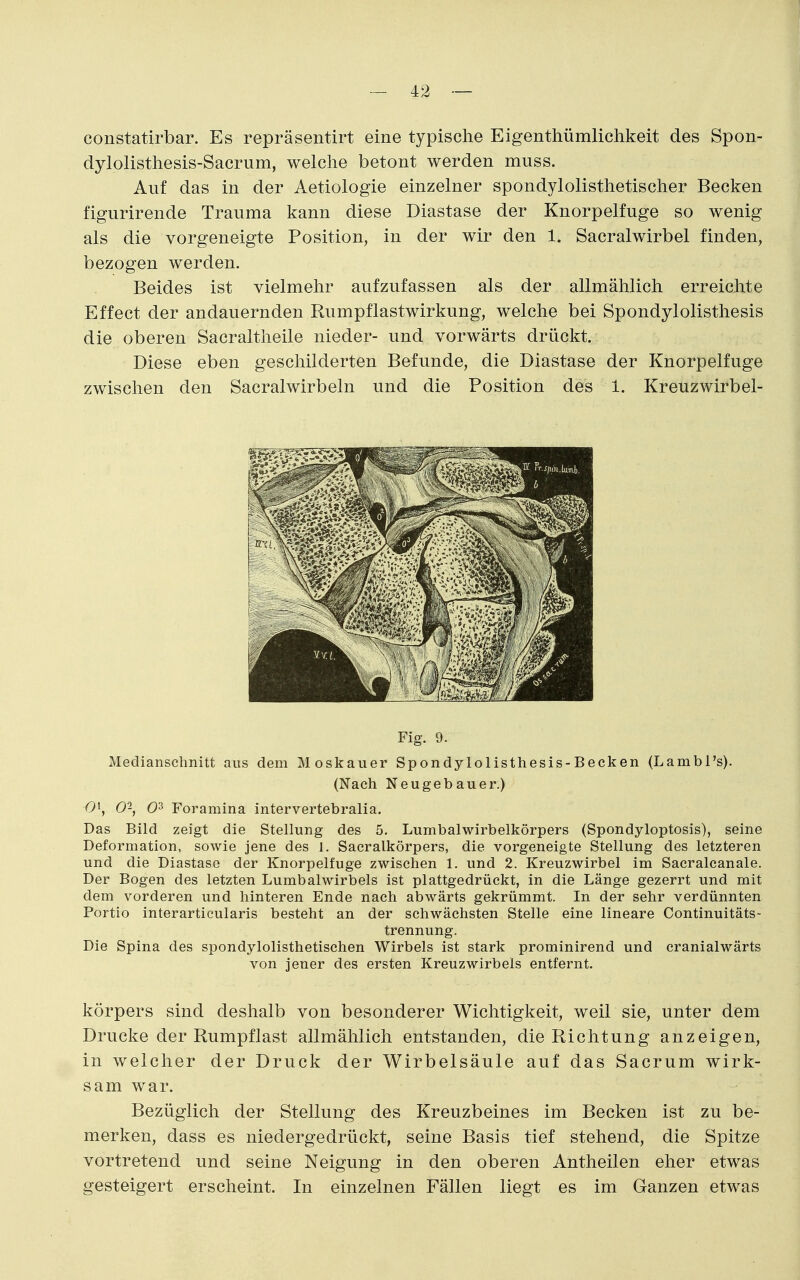 constatirbar. Es repräsentirt eine typische Eigenthümlichkeit des Spon- dylolisthesis-Sacrum, welche betont werden muss. Auf das in der Aetiologie einzelner spondylolisthetischer Becken figurirende Trauma kann diese Diastase der Knorpelfuge so wenig als die vorgeneigte Position, in der wir den 1. Sacralwirbel finden, bezogen werden. Beides ist vielmehr aufzufassen als der allmählich erreichte Effect der andauernden Rumpflastwirkung, welche bei Spondylolisthesis die oberen Sacraltheile nieder- und vorwärts drückt. Diese eben geschilderten Befunde, die Diastase der Knorpelfuge zwischen den Sacralwirbeln und die Position des 1. Kreuzwirbel- Fig. 9. Medianschnitt aus dem Moskauer Spondylolisthesis-Becken (Lambl's). (Nach Neugebauer.) 0\ 0-, 03 Foramina intervertebralia. Das Bild zeigt die Stellung des 5. Lumbalwirbelkörpers (Spondyloptosis), seine Deformation, sowie jene des 1. Sacralkörpers, die vorgeneigte Stellung des letzteren und die Diastase der Knorpelfuge zwischen 1. und 2. Kreuzwirbel im Sacralcanale. Der Bogen des letzten Lumbalwirbels ist plattgedrückt, in die Länge gezerrt und mit dem vorderen und hinteren Ende nach abwärts gekrümmt. In der sehr verdünnten Portio interarticularis besteht an der schwächsten Stelle eine lineare Continuitäts- trennung. Die Spina des spondylolisthetischen Wirbels ist stark prominirend und cranialwärts von jener des ersten Kreuzwirbels entfernt. körpers sind deshalb von besonderer Wichtigkeit, weil sie, unter dem Drucke der Rumpf last allmählich entstanden, die Richtung anzeigen, in welcher der Druck der Wirbelsäule auf das Sacrum wirk- sam war. Bezüglich der Stellung des Kreuzbeines im Becken ist zu be- merken, dass es niedergedrückt, seine Basis tief stehend, die Spitze vortretend und seine Neigung in den oberen Antheilen eher etwas gesteigert erscheint. In einzelnen Fällen liegt es im Ganzen etwas