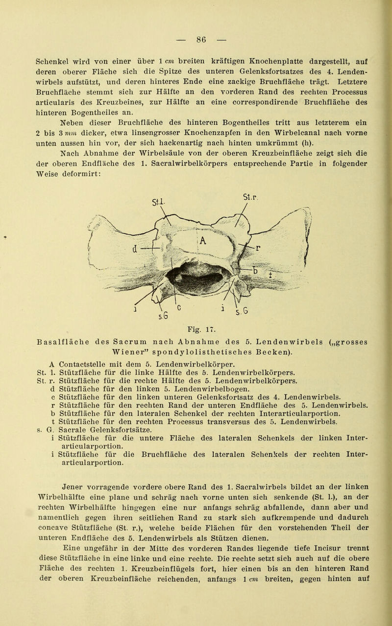 Schenkel wird von einer über 1 cm breiten kräftigen Knochenplatte dargestellt, auf deren oberer Fläche sich die Spitze des unteren Gelenksfortsatzes des 4. Lenden- wirbels aufstützt, und deren hinteres Ende eine zackige Bruchfläche trägt. Letztere Bruchfläche stemmt sich zur Hälfte an den vorderen Rand des rechten Processus articularis des Kreuzbeines, zur Hälfte an eine correspondirende Bruchfläche des hinteren Bogentheiles an. Neben dieser Bruchfläche des hinteren Bogentheiles tritt aus letzterem ein 2 bis 3 mm dicker, etwa linsengrosser Knochenzapfen in den Wirbelcanal nach vorne unten aussen hin vor, der sich hackenartig nach hinten umkrümmt (h). Nach Abnahme der Wirbelsäule von der oberen Kreuzbeinfläehe zeigt sich die der oberen Endfläche des 1. Sacralwirbelkörpers entsprechende Partie in folgender Weise deformirt: Basalfläche des Sacrum nach Abnahme des 5. Lendenwirbels („grosses Wiener spondylolisthetisches Becken). A Contactstelle mit dem 5. Lendenwirbelkörper. St. 1. Stützfläche für die linke Hälfte des 5. Lendenwirbelkörpers. St. r. Stützfläche für die rechte Hälfte des 5. Lendenwirbelkörpers. d Stützfläche für den linken 5. Lendenwirbelbogen. c Stützfläche für den linken unteren Gelenksfortsatz des 4. Lendenwirbels, r Stützfläche für den rechten Rand der unteren Endfläche des 5. Lendenwirbels, b Stützfläche für den lateralen Schenkel der rechten Interarticularportion. t Stützfläche für den rechten Processus transversus des 5. Lendenwirbels, s. G. Sacrale Gelenksfortsätze. i Stützfläche für die untere Fläche des lateralen Schenkels der linken Inter- articularportion. i Stützfläche für die Bruchfläche des lateralen Schenkels der rechten Inter- articularportion. Jener vorragende vordere obere Rand des 1. Sacralwirbels bildet an der linken Wirbelhälfte eine plane und schräg nach vorne unten sich senkende (St. 1.), an der rechten Wirbelhälfte hingegen eine nur anfangs schräg abfallende, dann aber und namentlich gegen ihren seitlichen Rand zu stark sich aufkrempende und dadurch concave Stützfläche (St. r.), welche beide Flächen für den vorstehenden Theil der unteren Endfläche des 5. Lendenwirbels als Stützen dienen. Eine ungefähr in der Mitte des vorderen Randes liegende tiefe Incisur trennt diese Stützfläche in eine linke und eine rechte. Die rechte setzt sich auch auf die obere Fläche des rechten 1. Kreuzbeinflügels fort, hier einen bis an den hinteren Rand der oberen Kreuzbeinfläche reichenden, anfangs 1 cm breiten, gegen hinten auf